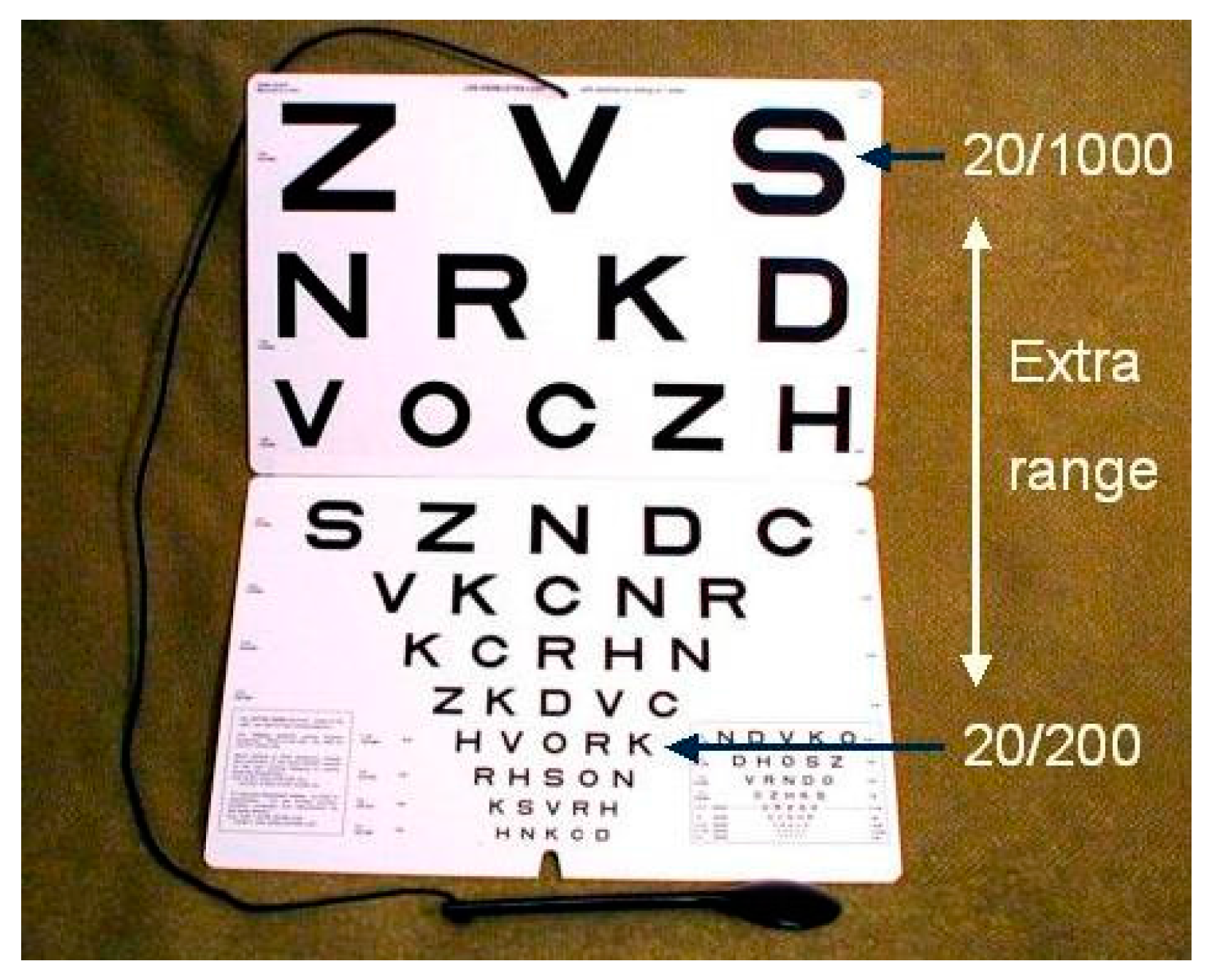 Vision 02 00004 g0a3