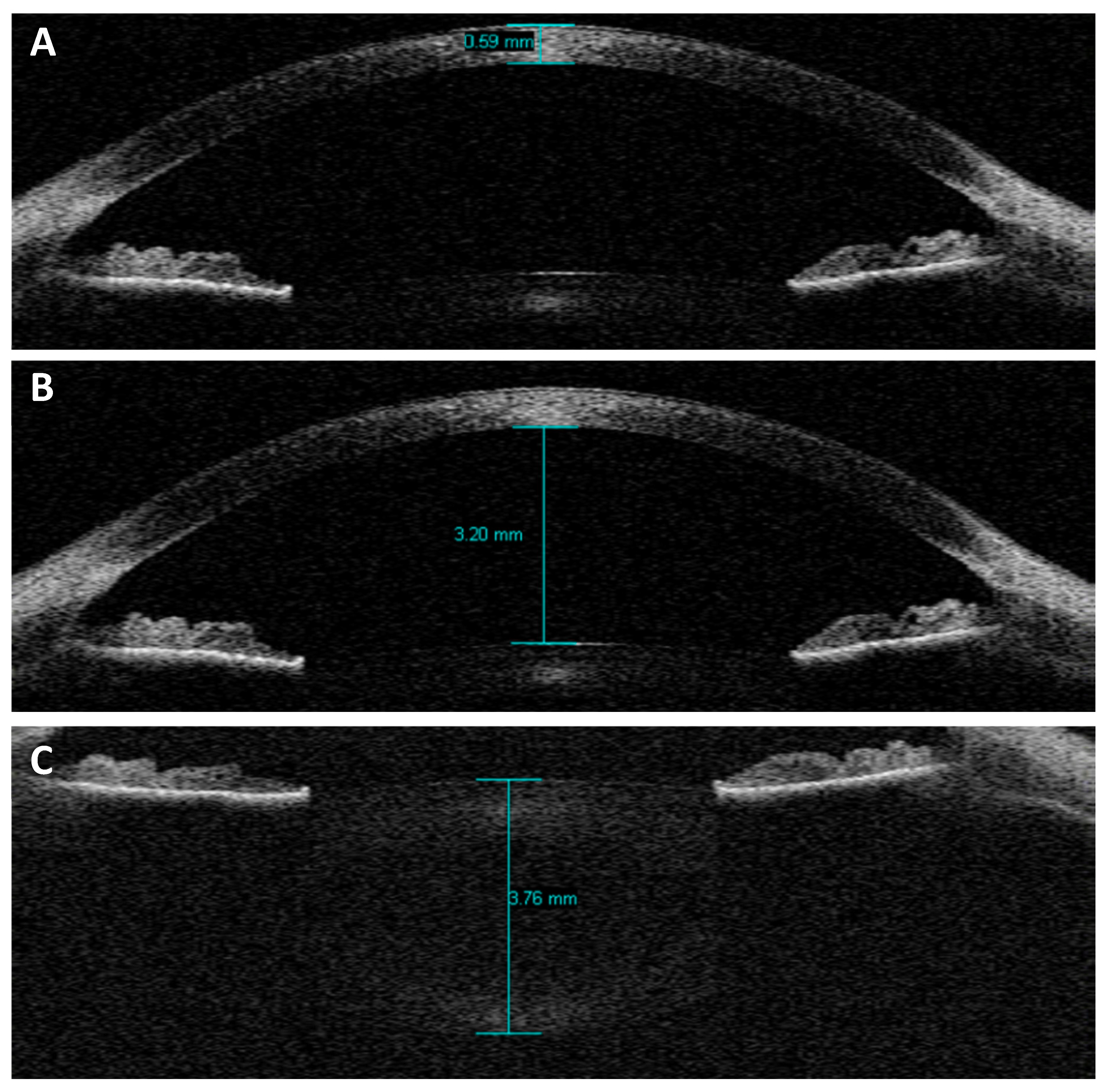 Vision 02 00033 g001 Vision 02 00033 g001