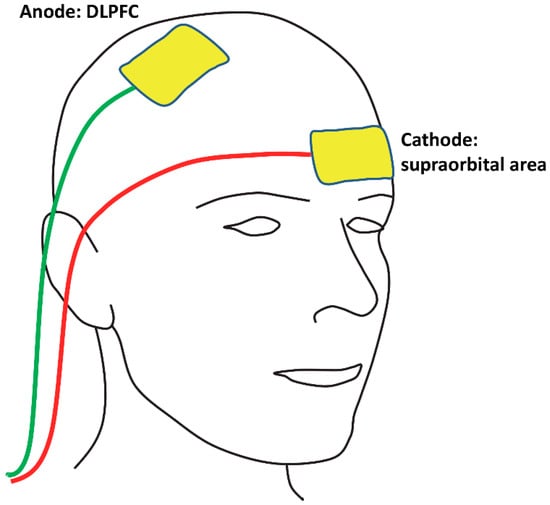 dorsolateral prefrontal cortex tdcs