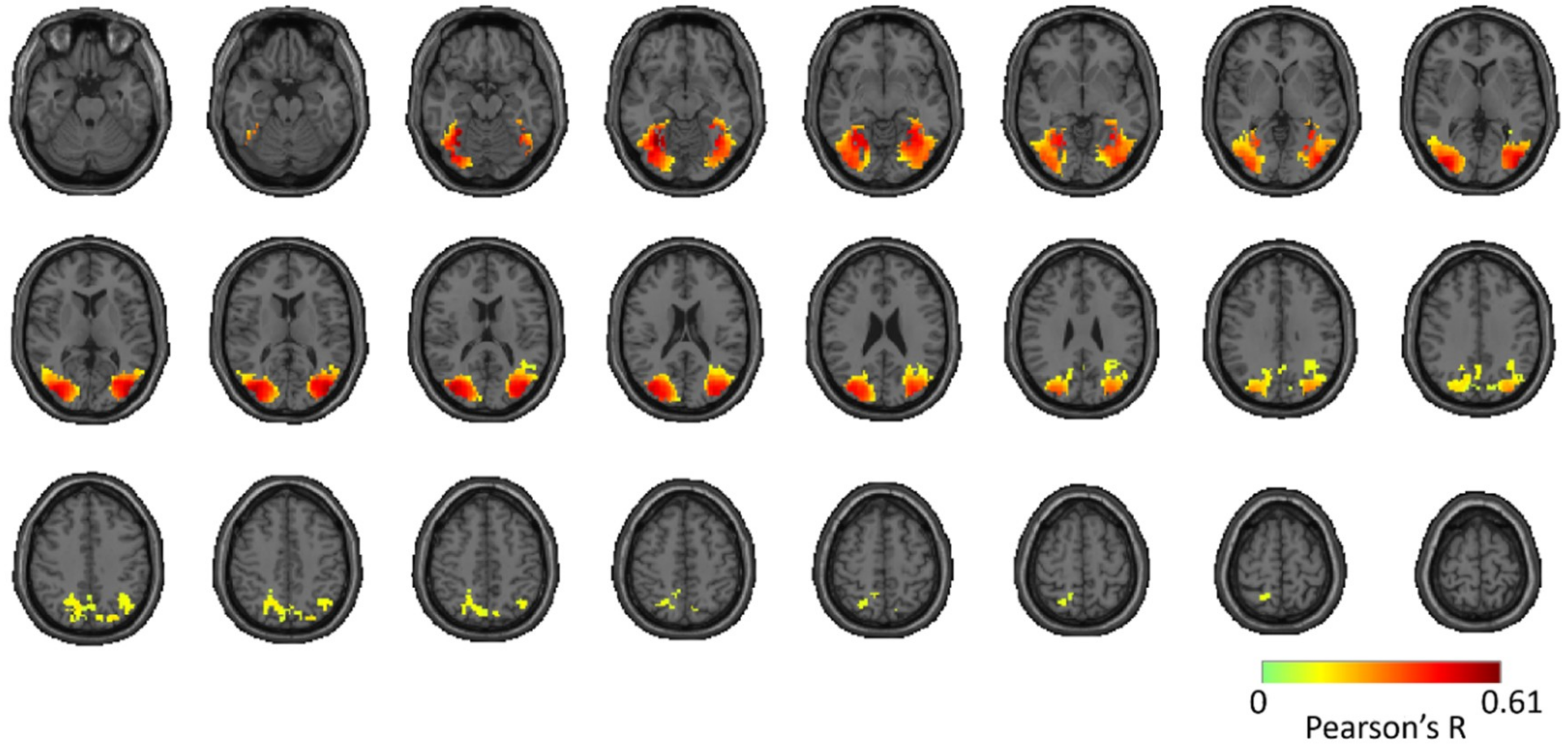 Vision 03 00008 g005 Vision 03 00008 g005