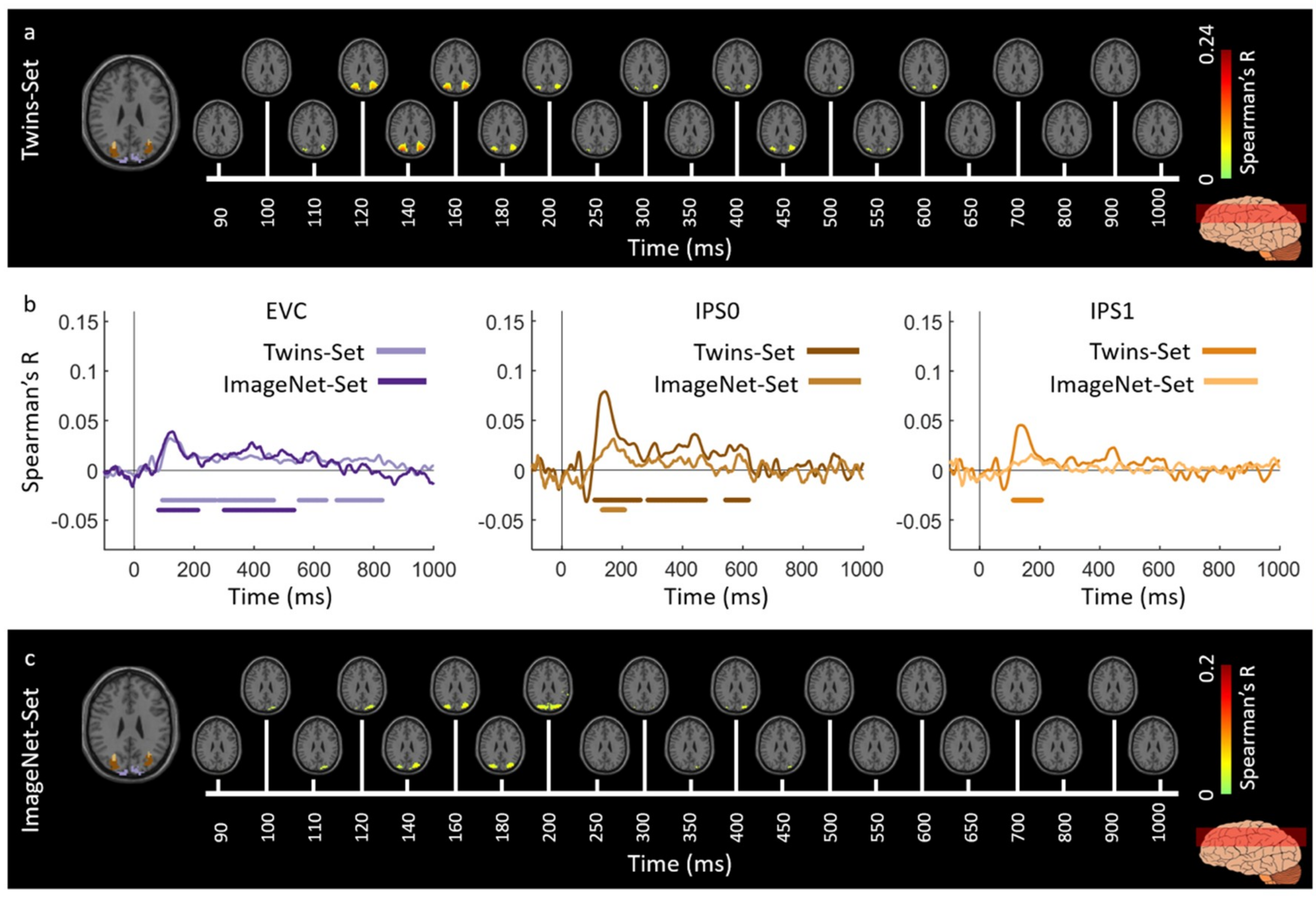 Vision 03 00008 g007 Vision 03 00008 g007