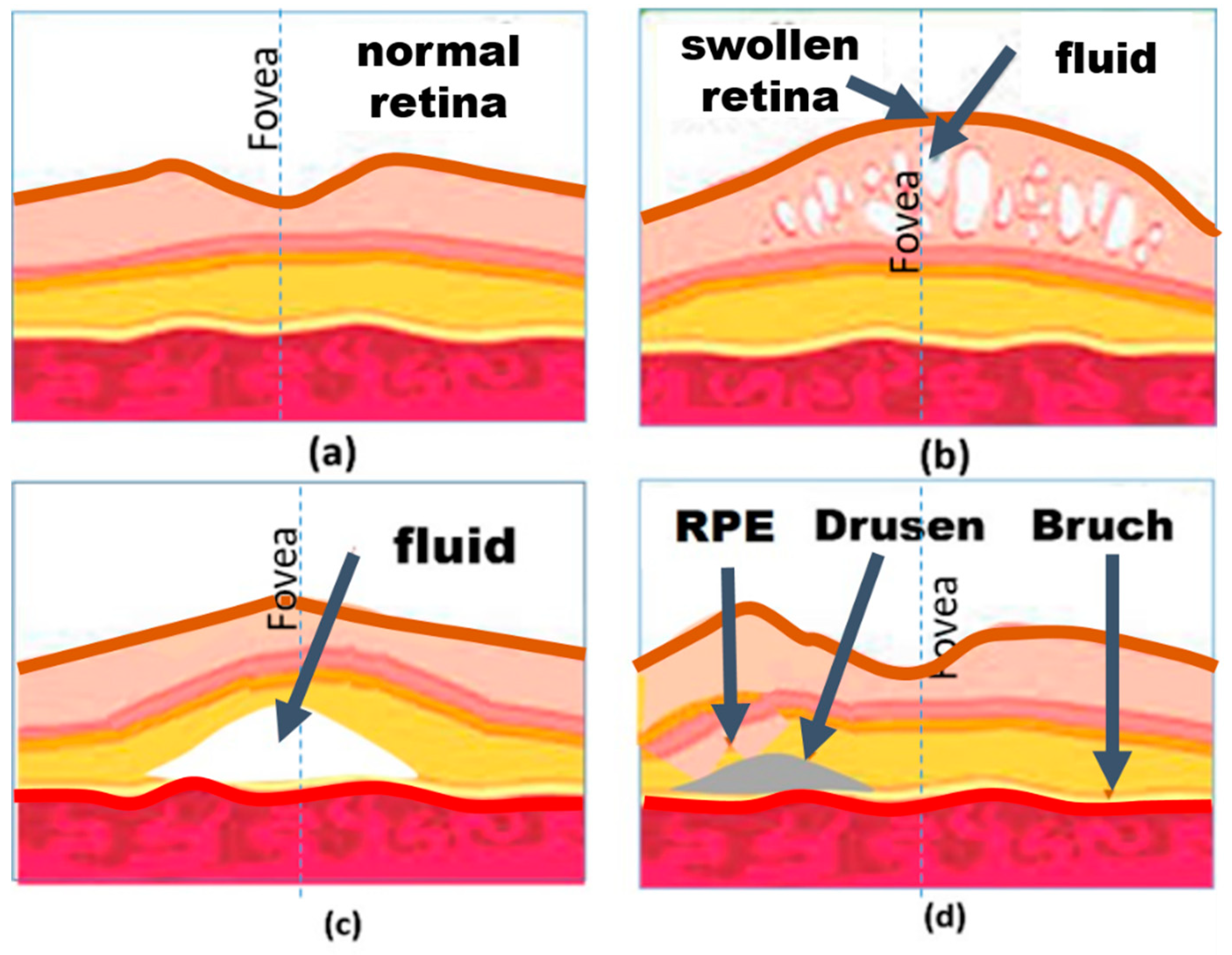 Vision 03 00025 g002 Vision 03 00025 g002