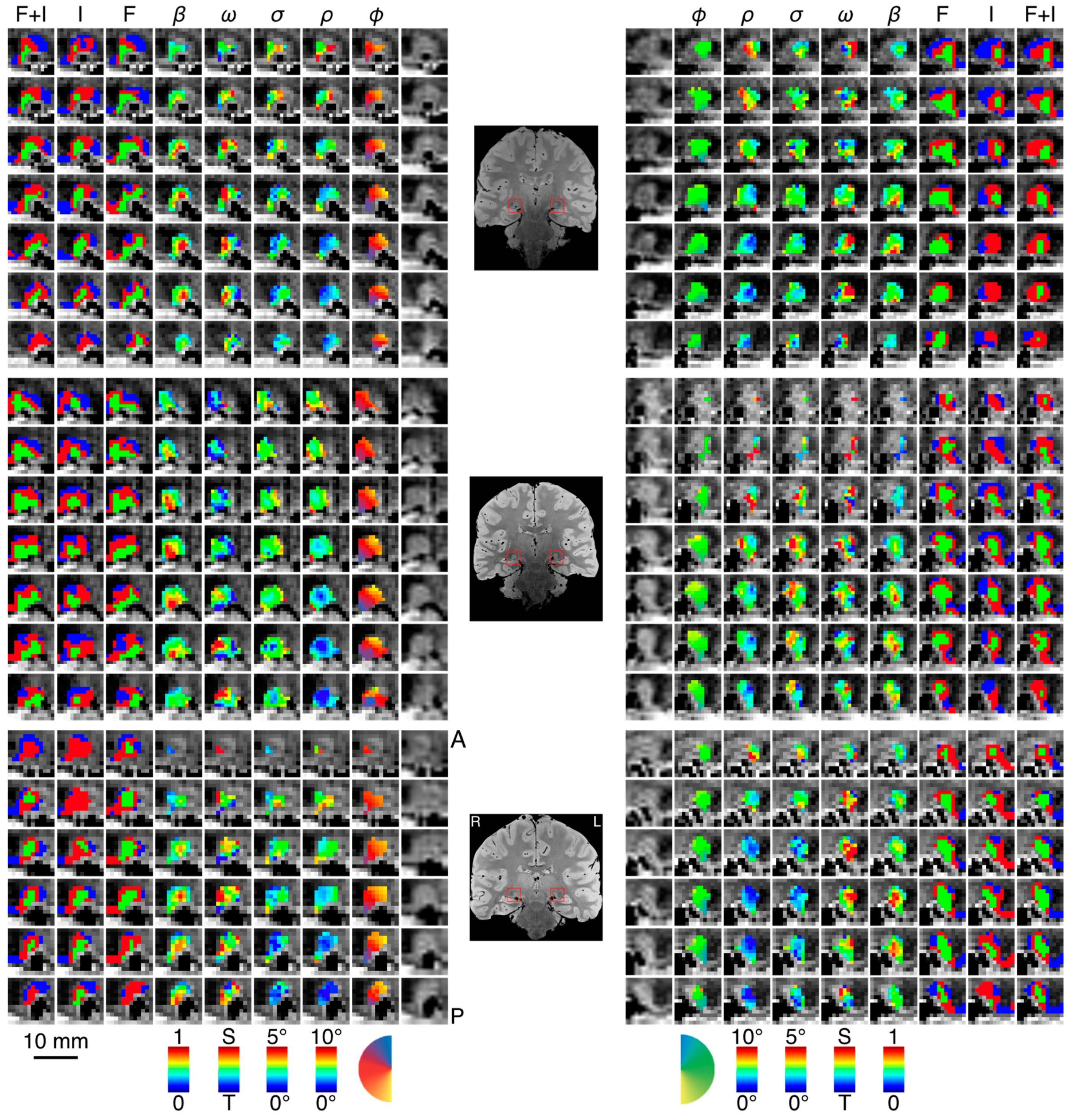 Vision 03 00027 g003 Vision 03 00027 g003
