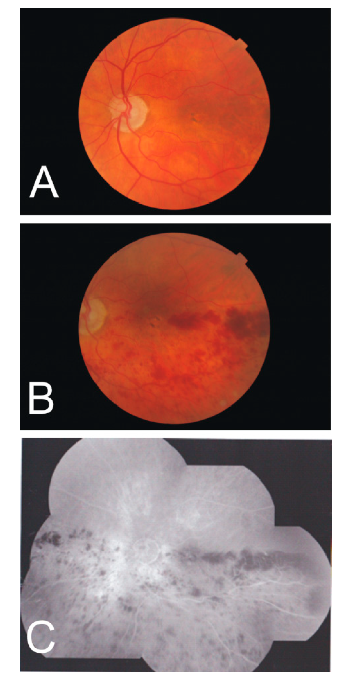 Vision 03 00060 g005 Vision 03 00060 g005