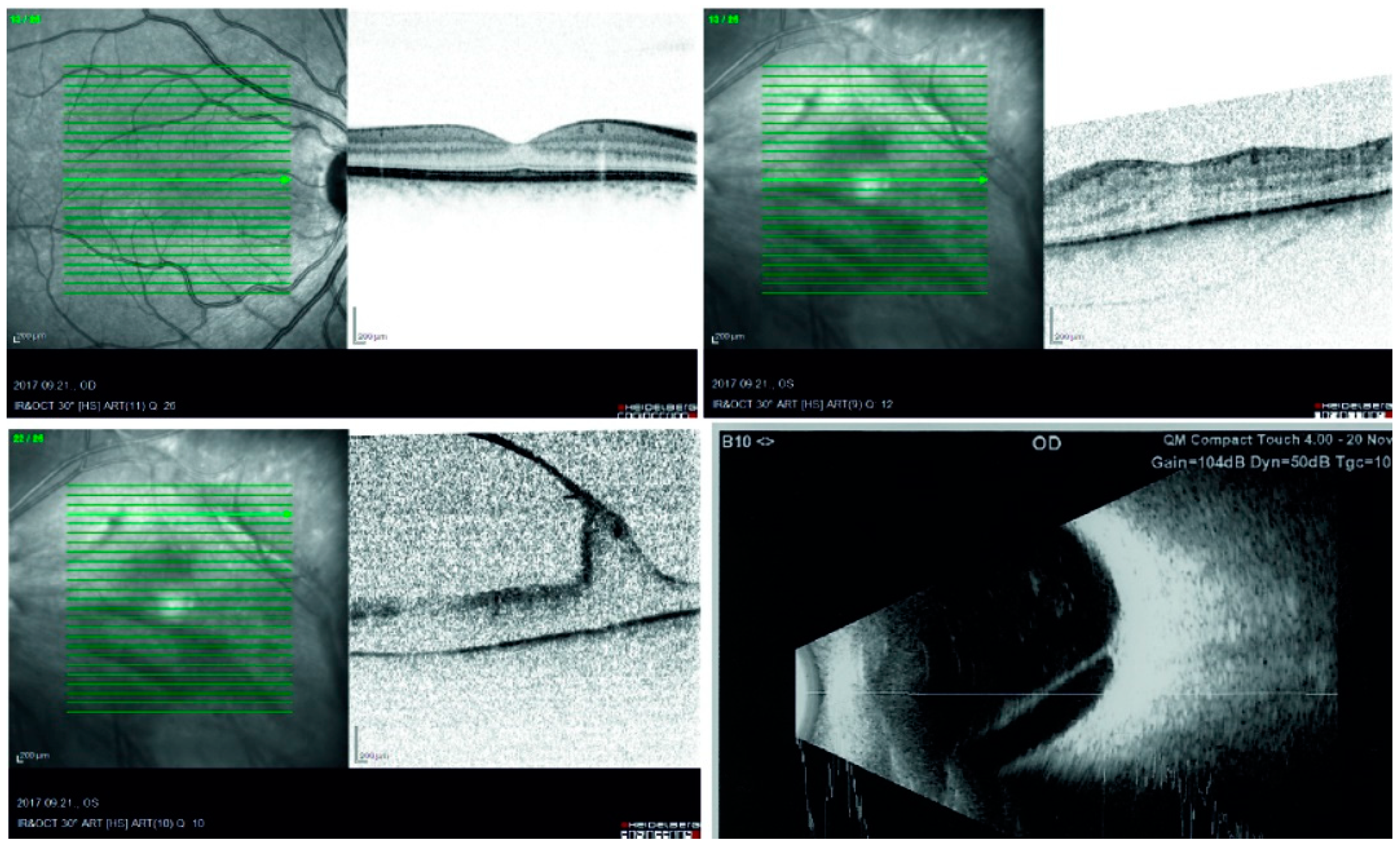 Vision 04 00005 g001 Vision 04 00005 g001