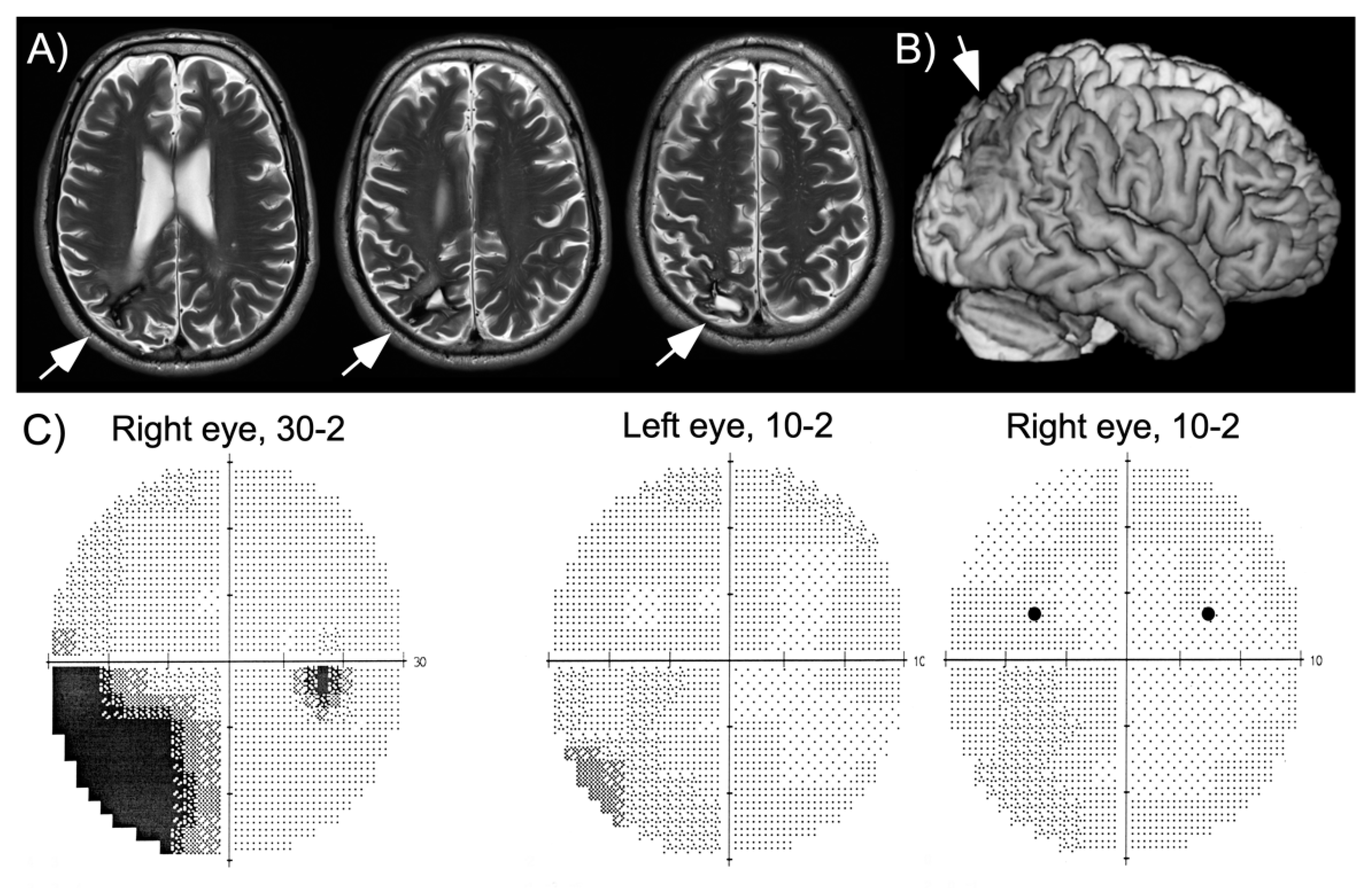 Vision 04 00016 g001
