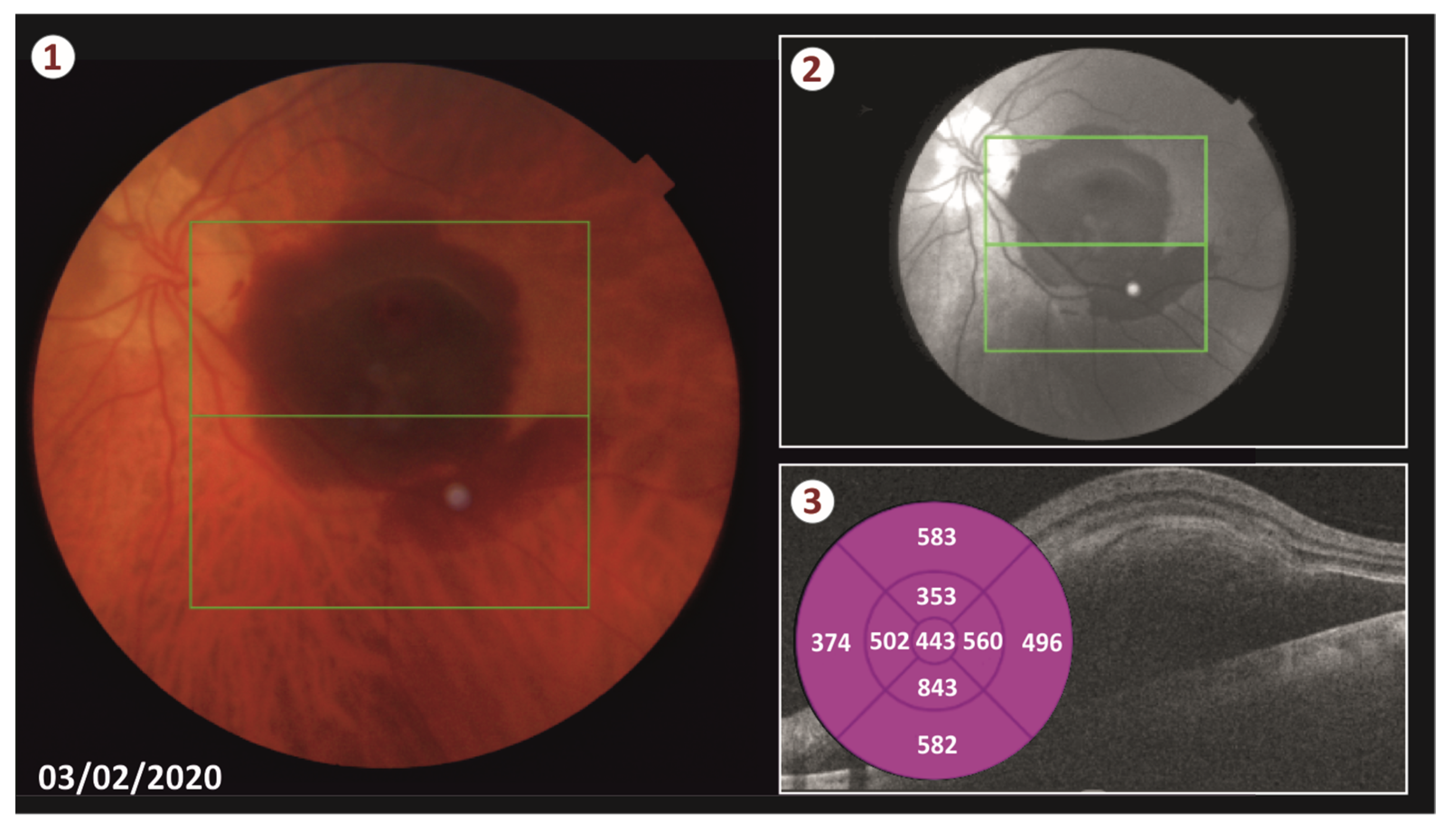 Vision 05 00023 g001