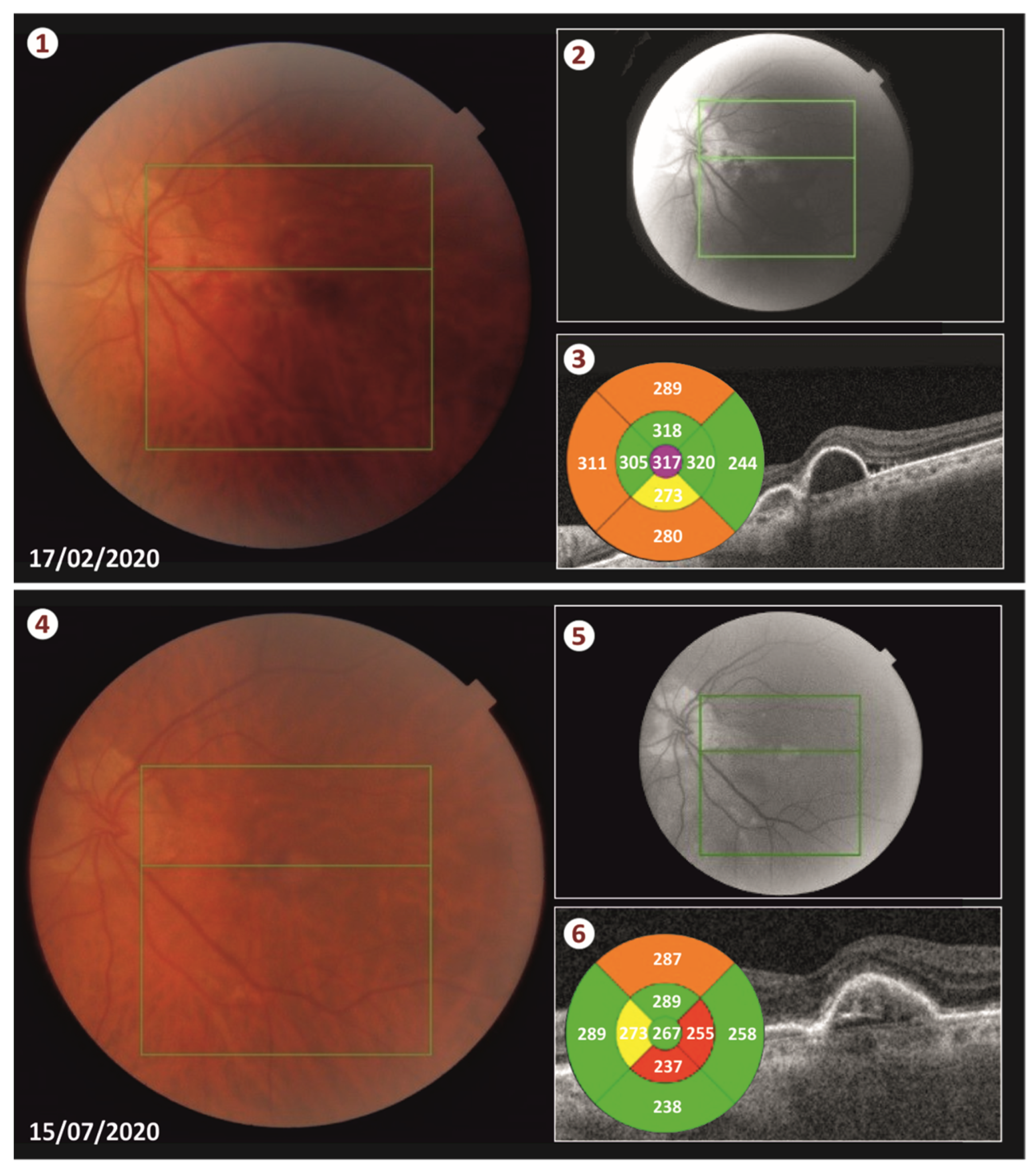 Vision 05 00023 g003