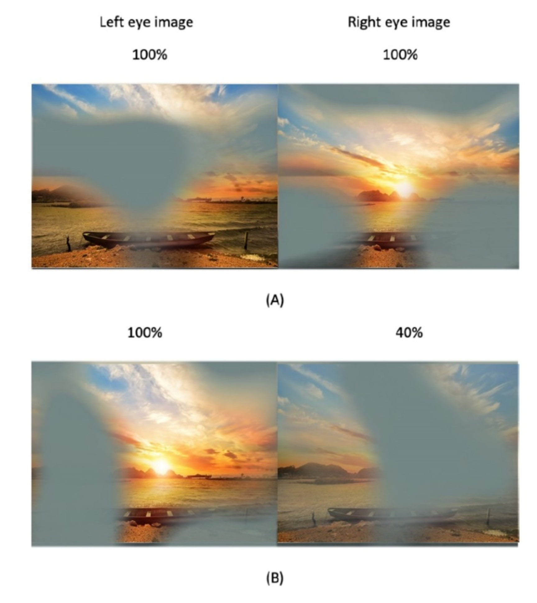 Vision Free FullText Current Management of Amblyopia with New