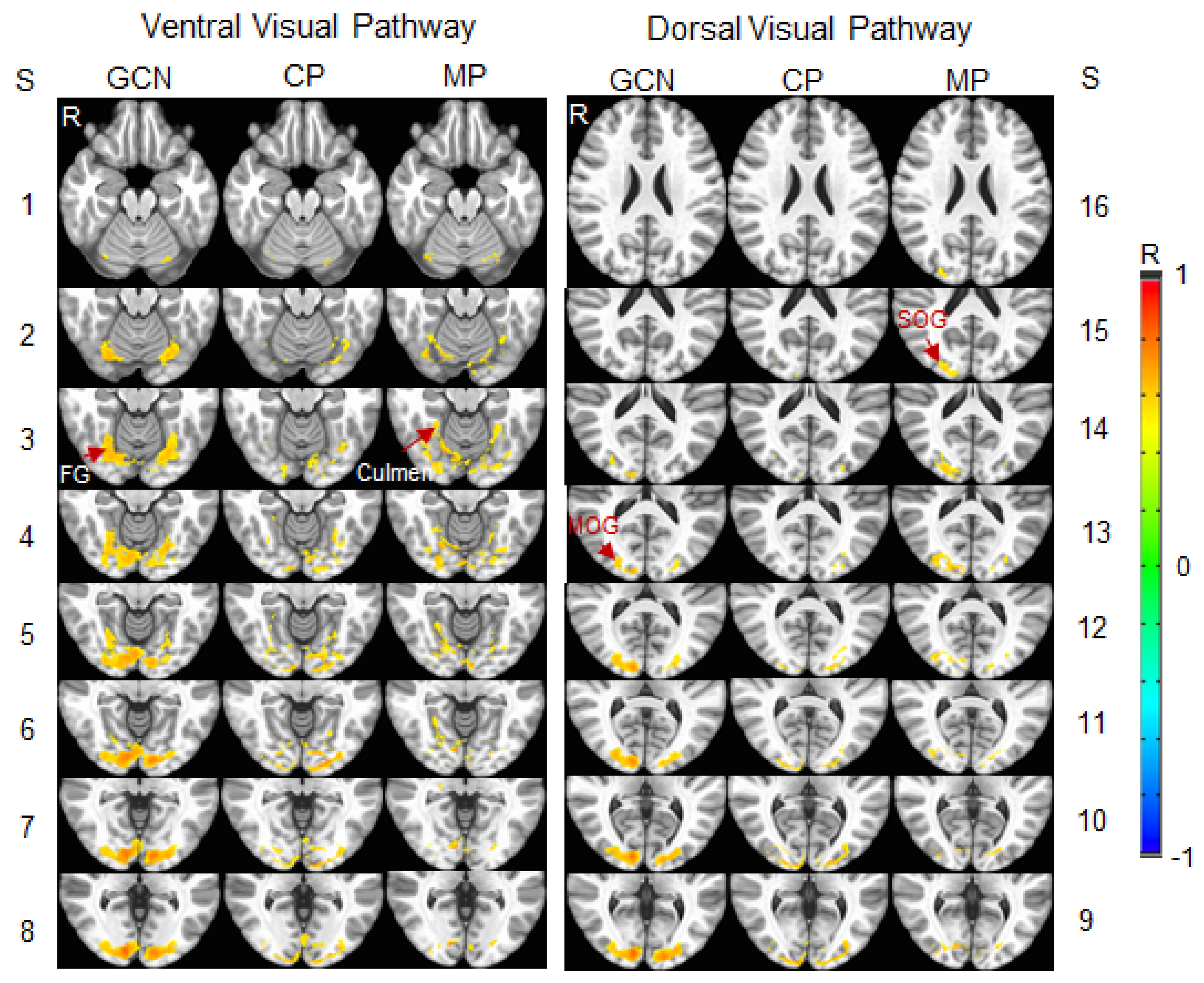 Vision 05 00057 g007