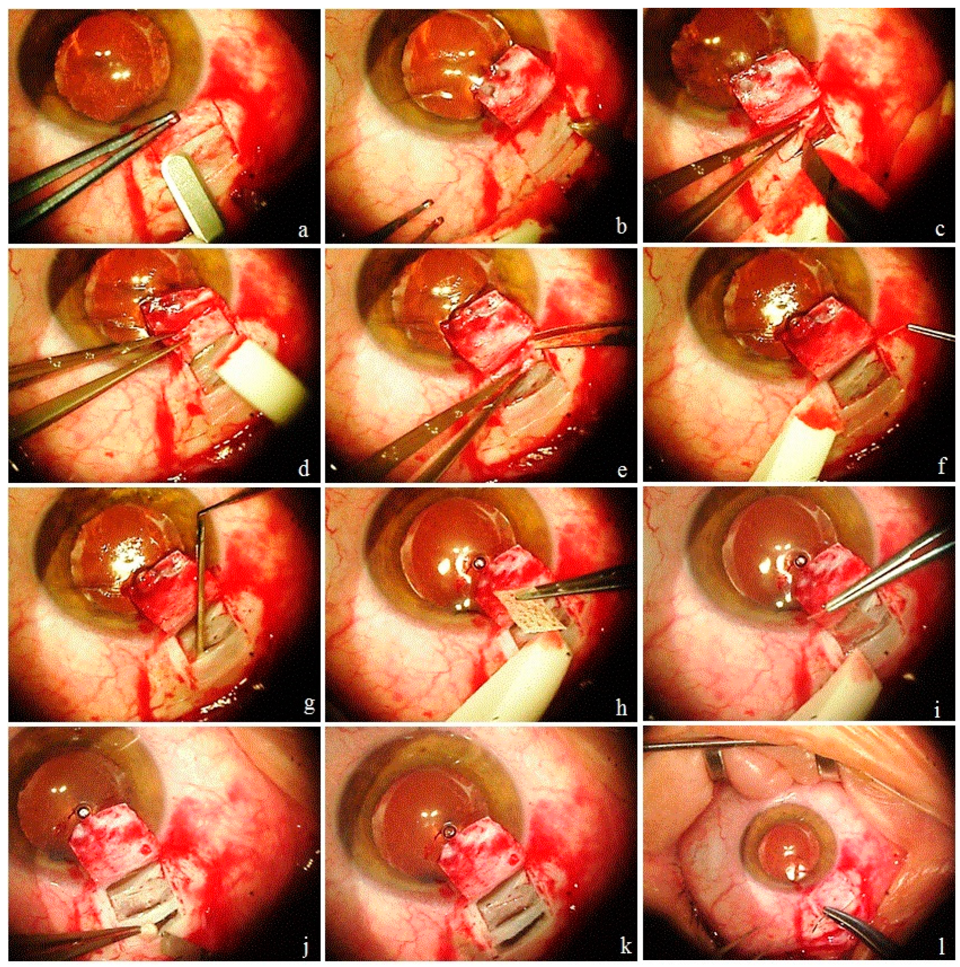 Vision 06 00004 g001 550