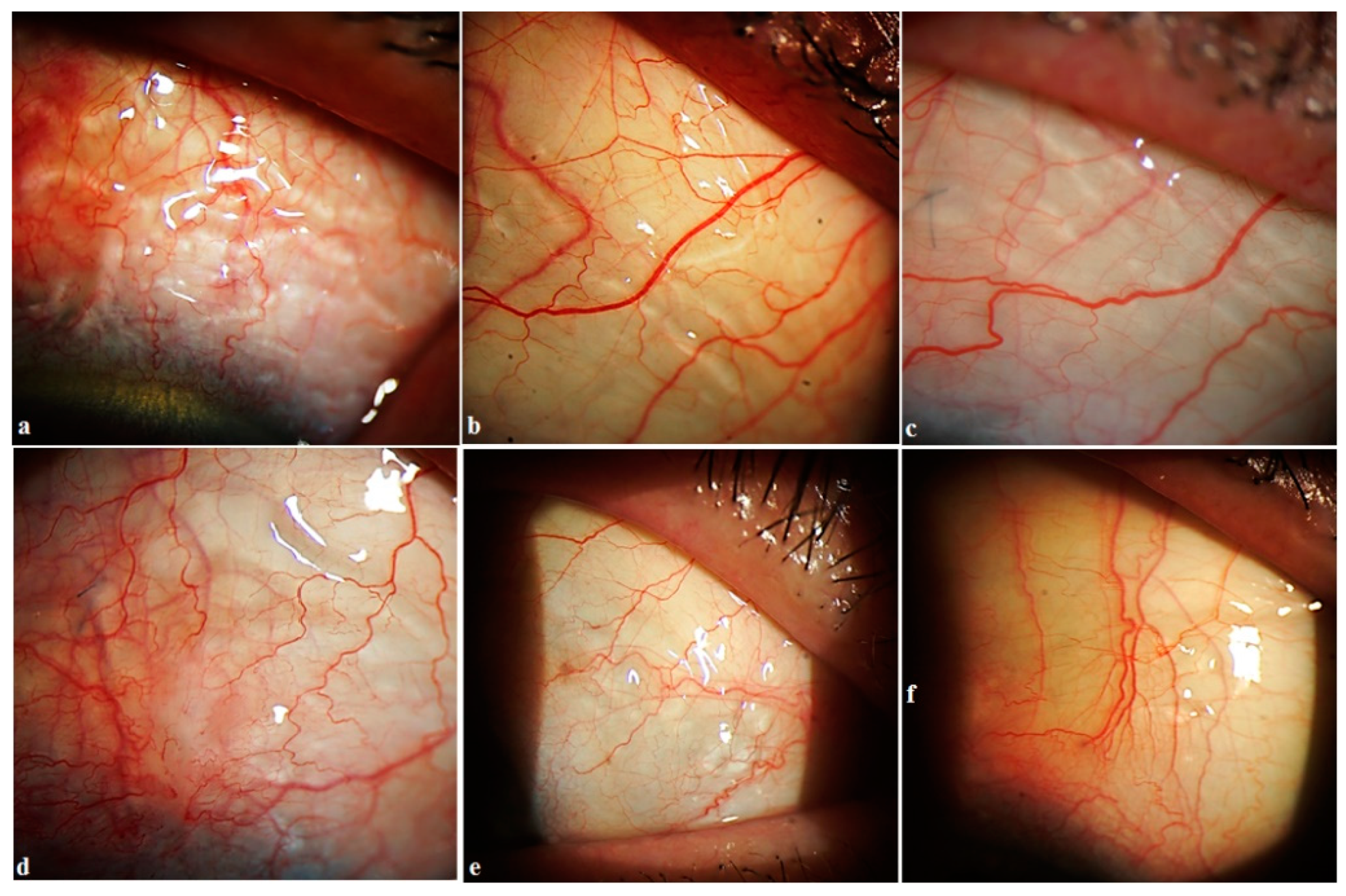 Vision 06 00004 g007 550