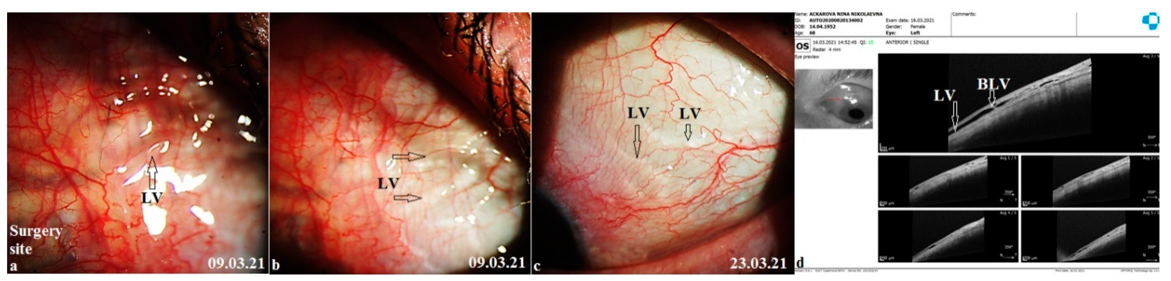 Vision 06 00004 g008 550