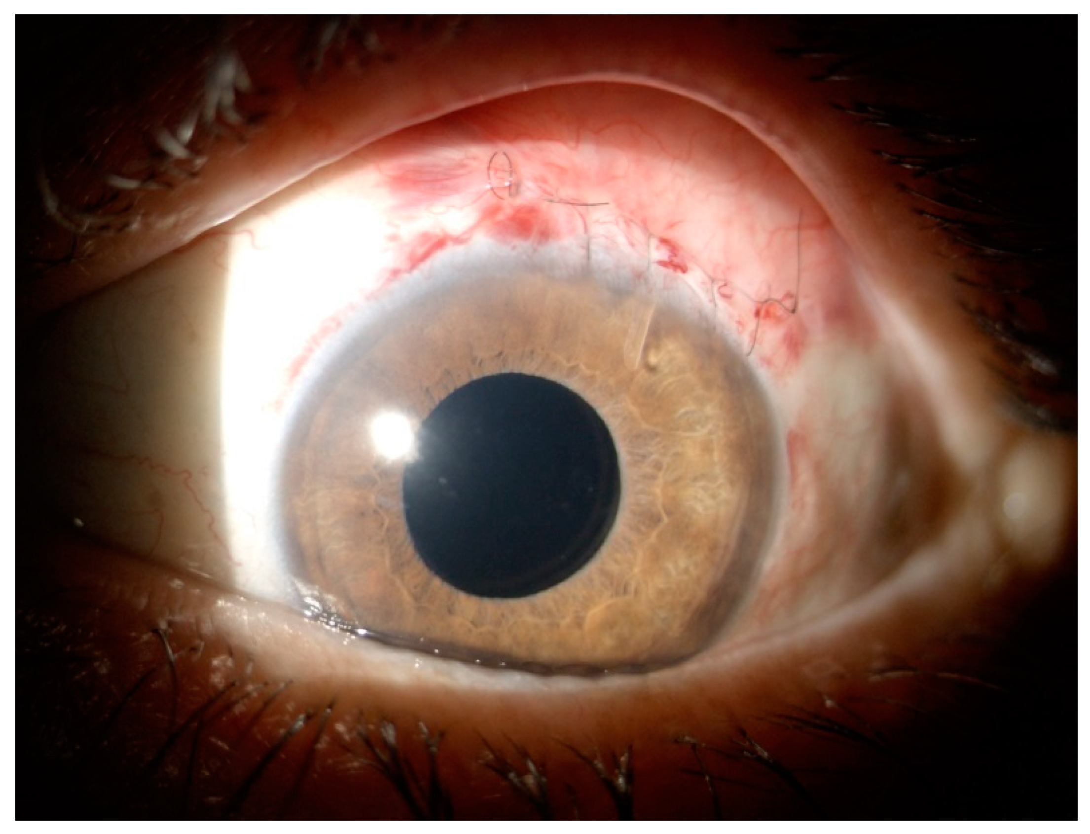 Vision 06 00012 g003 Vision 06 00012 g003