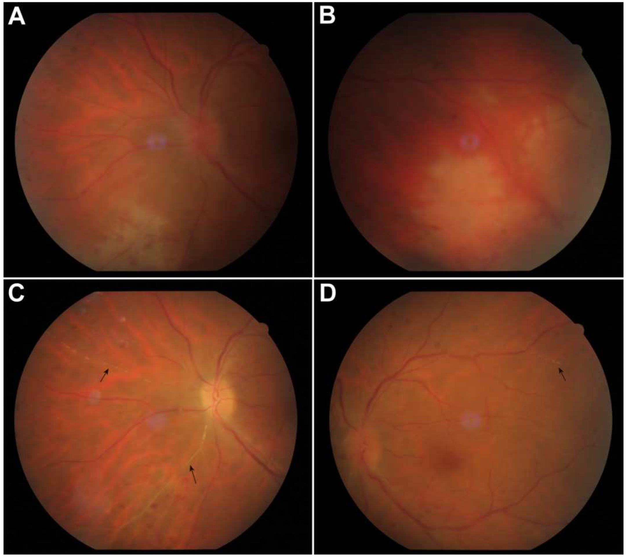 Vision 06 00027 g001 550