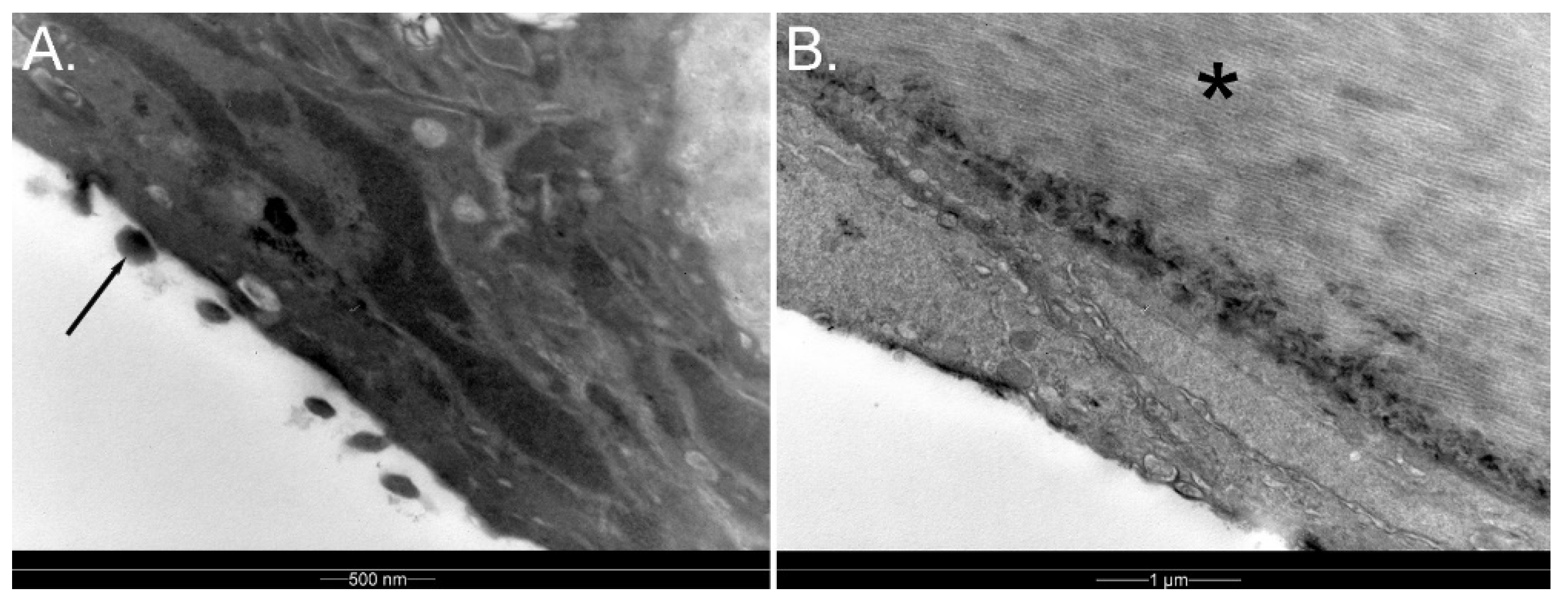 Vision 07 00006 g004 Vision 07 00006 g004