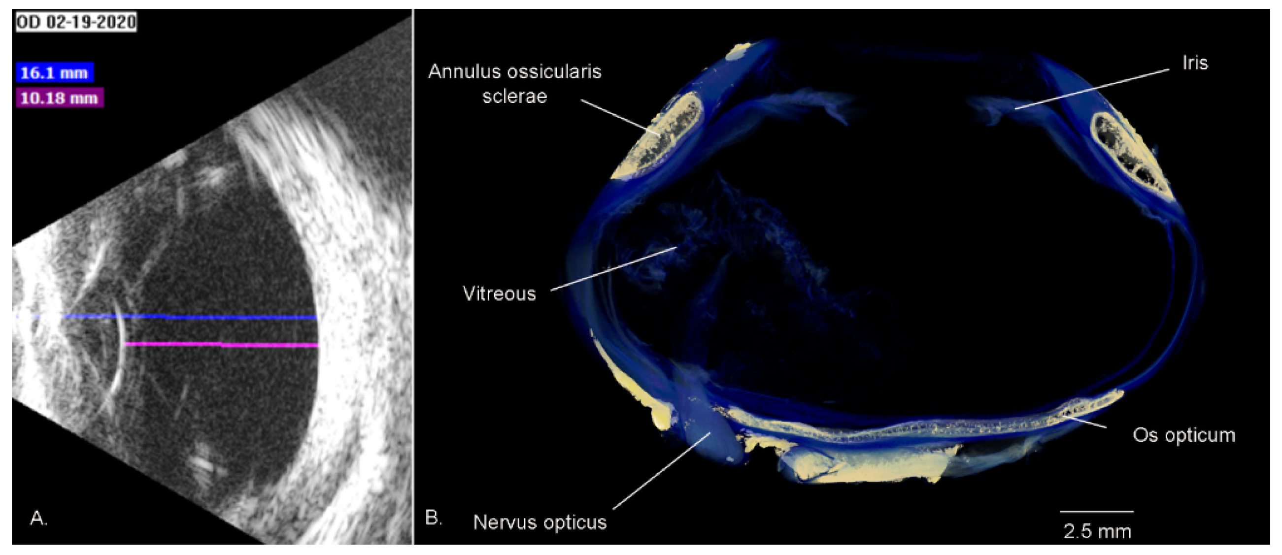 Vision 07 00006 g005 Vision 07 00006 g005