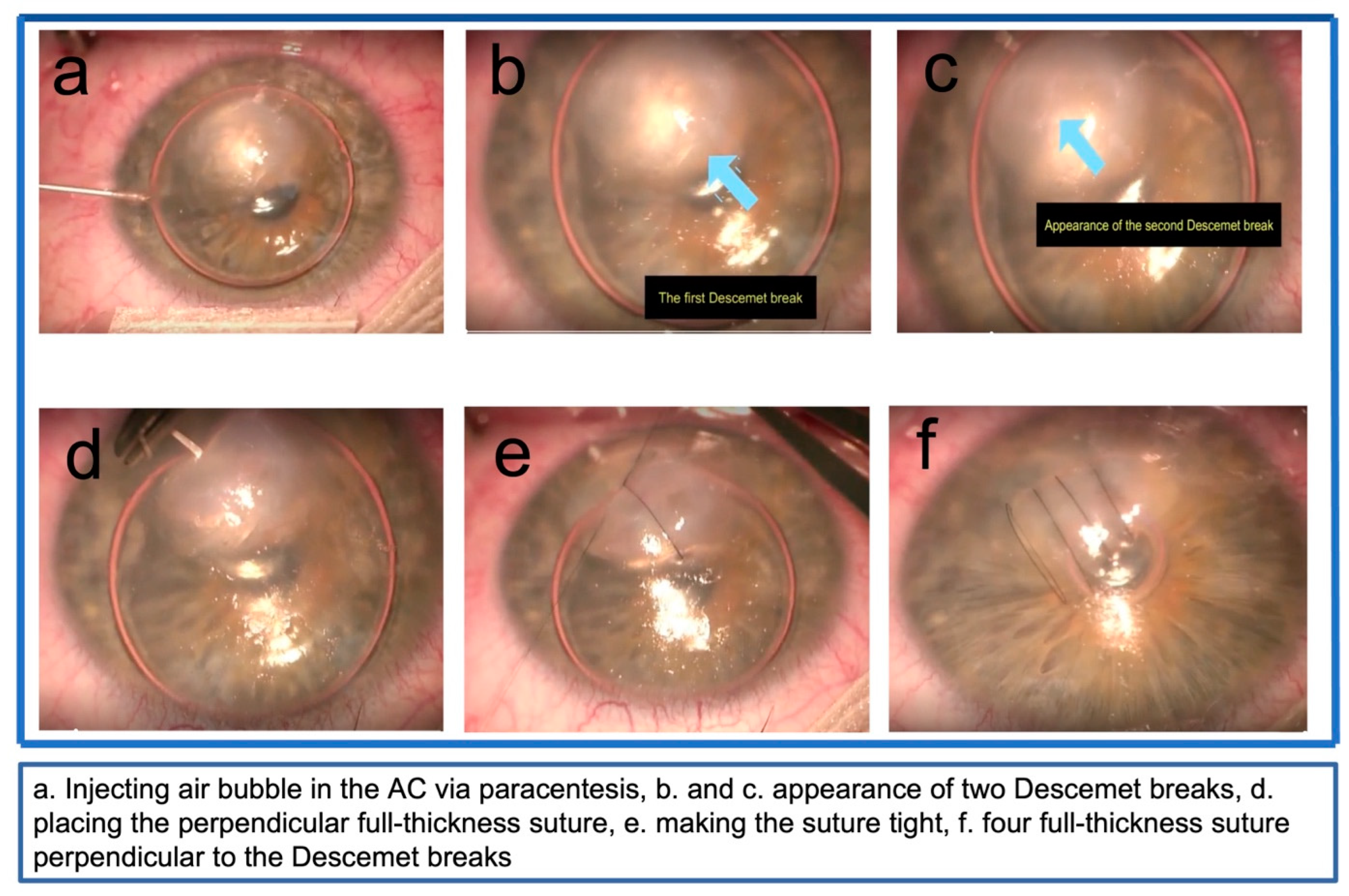 Vision 07 00010 g001