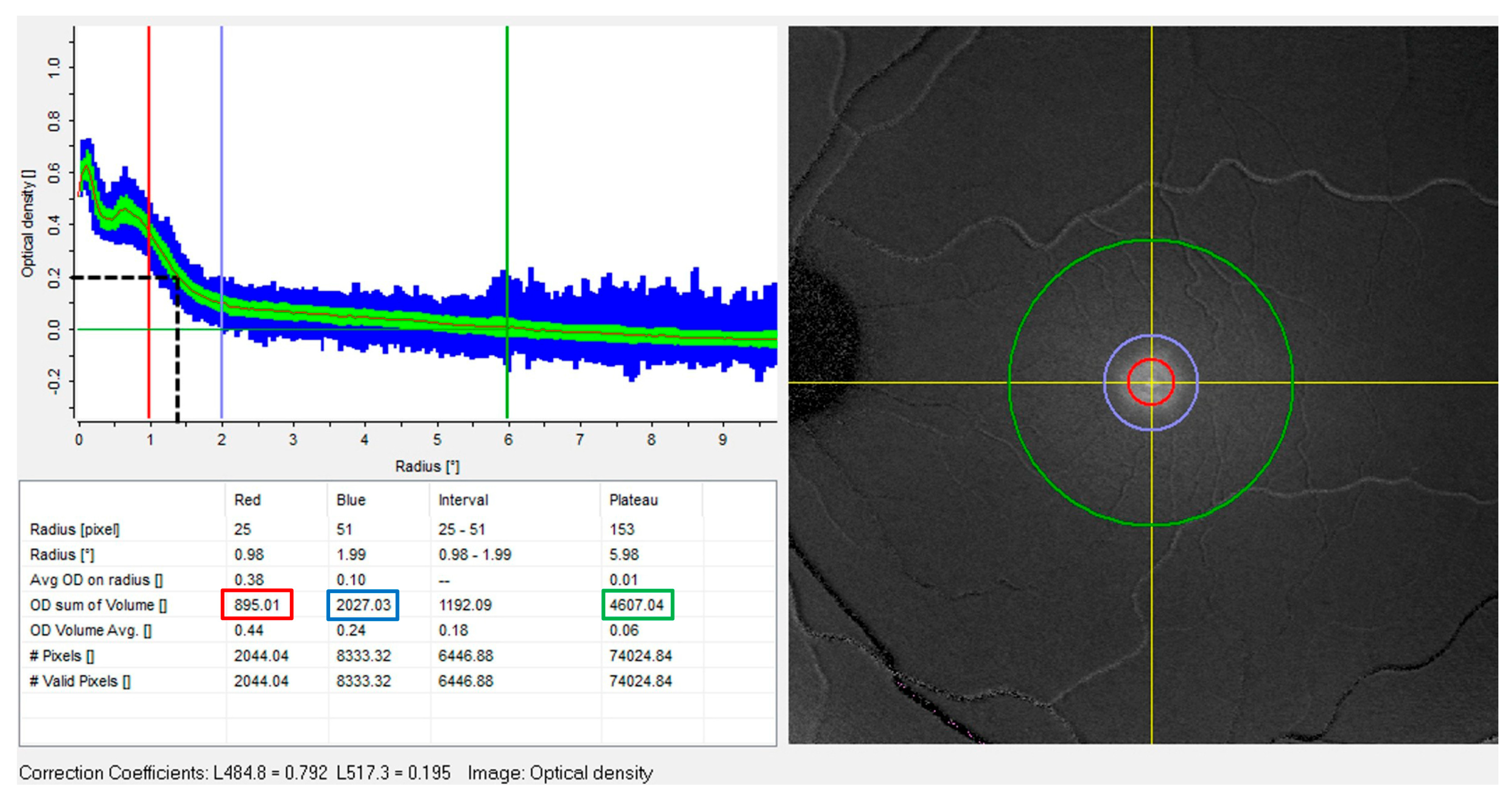 Vision 07 00011 g001 Vision 07 00011 g001