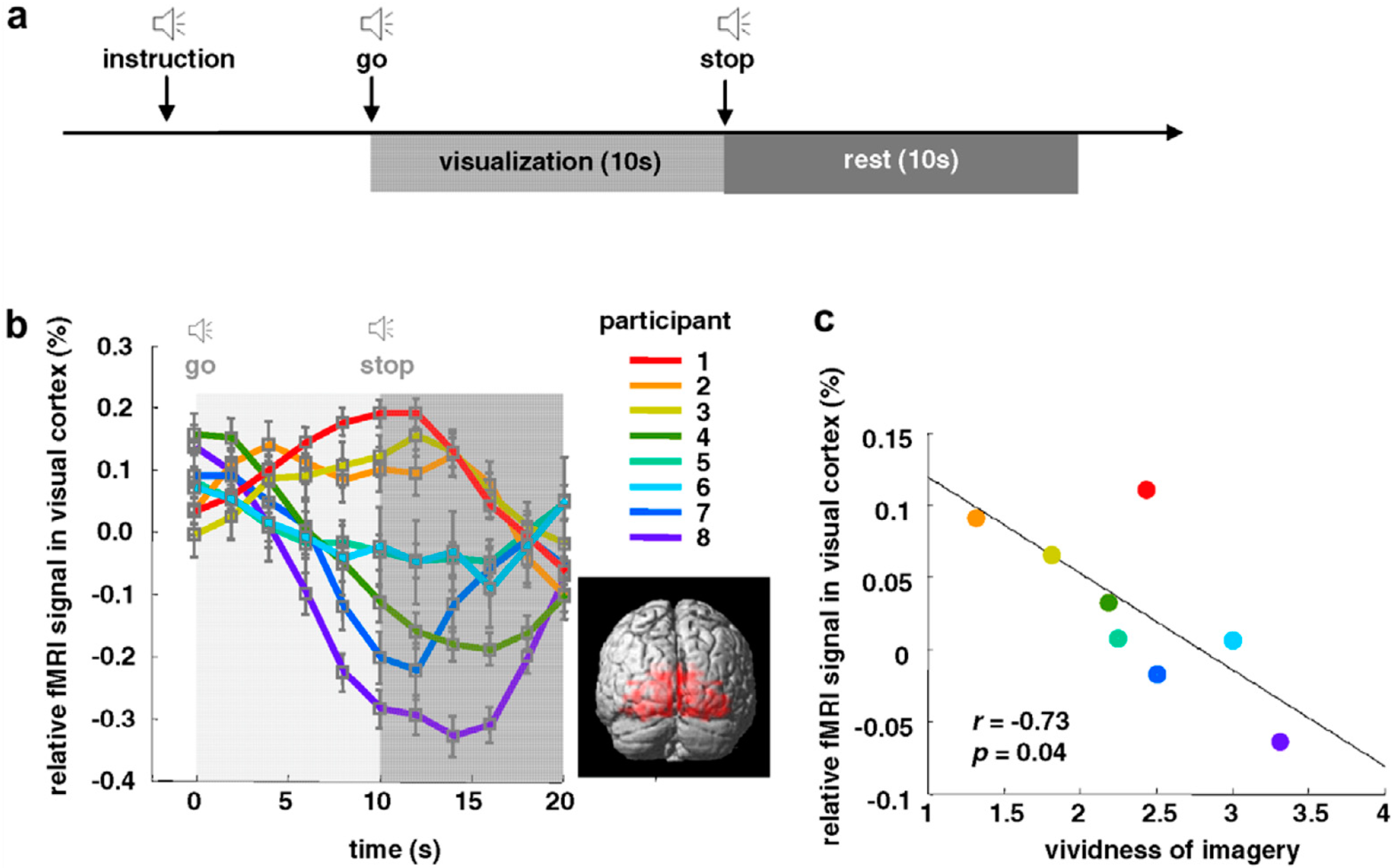 Vision 07 00012 g005 Vision 07 00012 g005