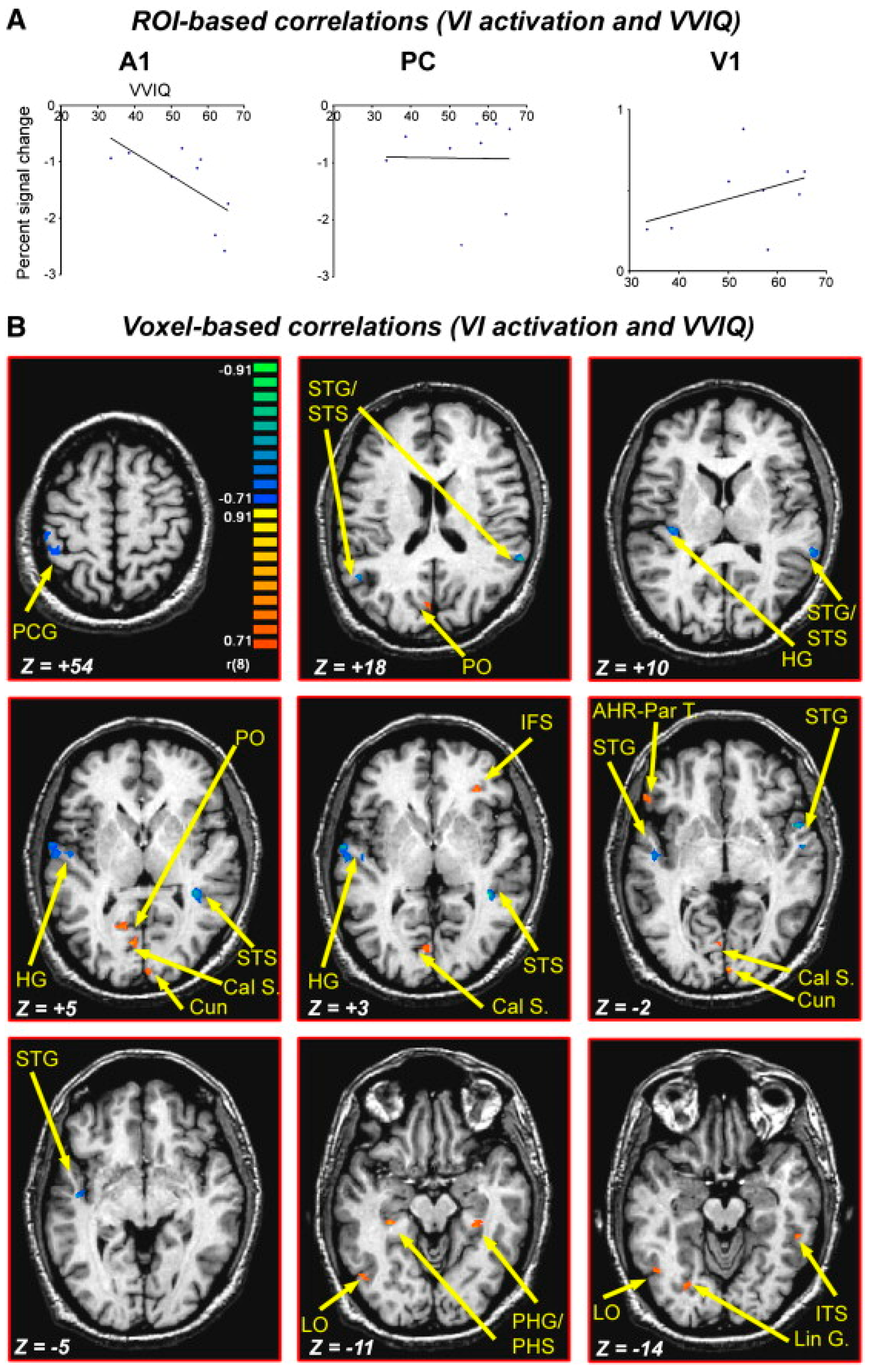 Vision 07 00012 g006 Vision 07 00012 g006