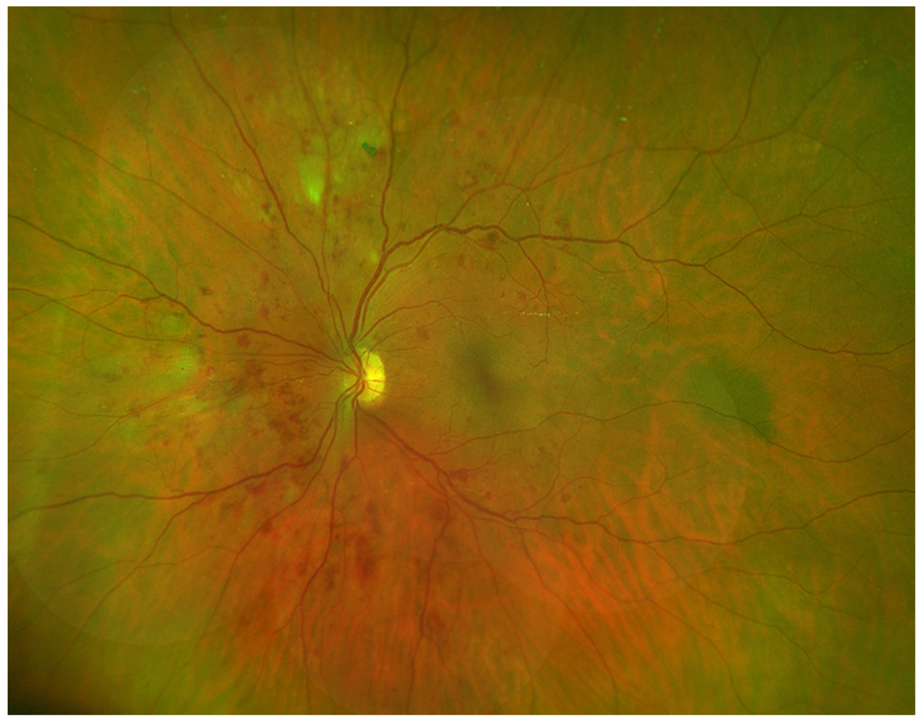 Vision 07 00018 g002