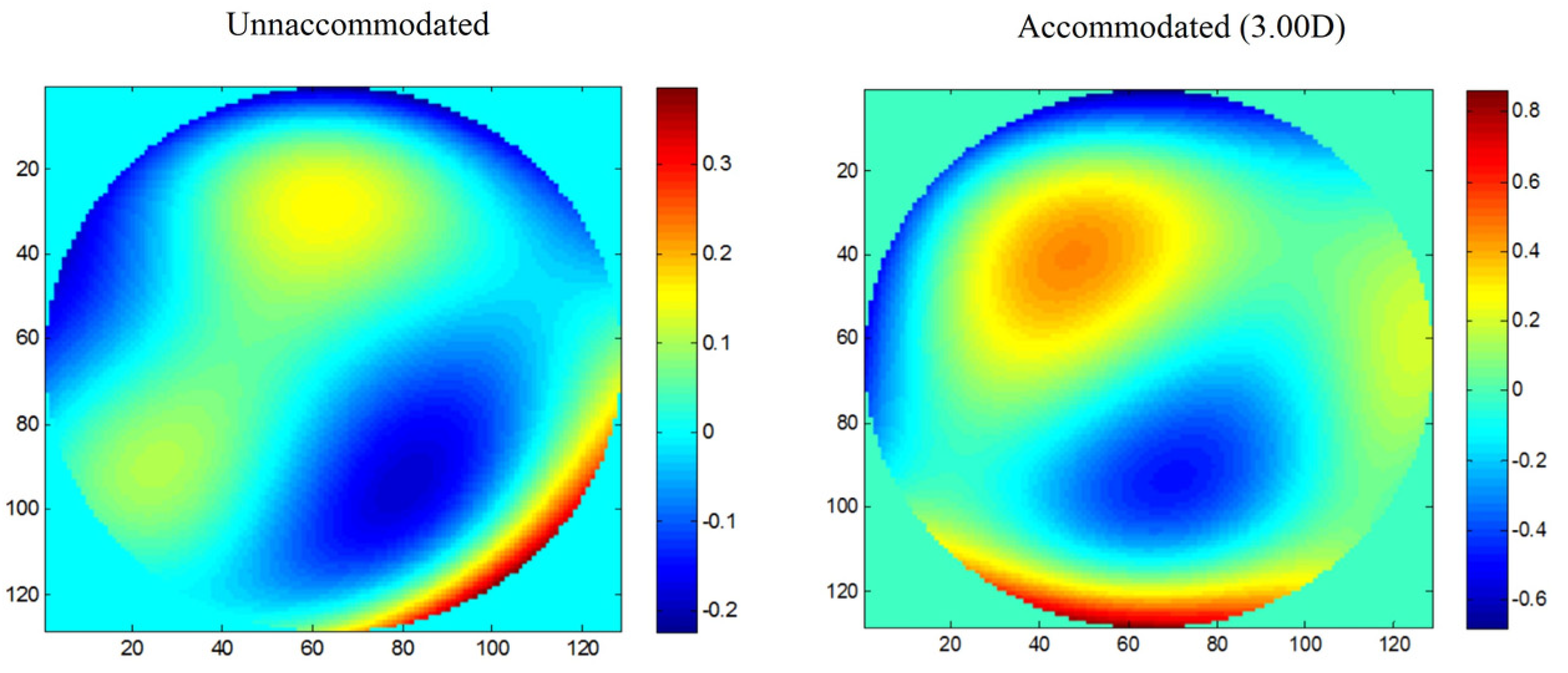 Vision 07 00019 g003 Vision 07 00019 g003