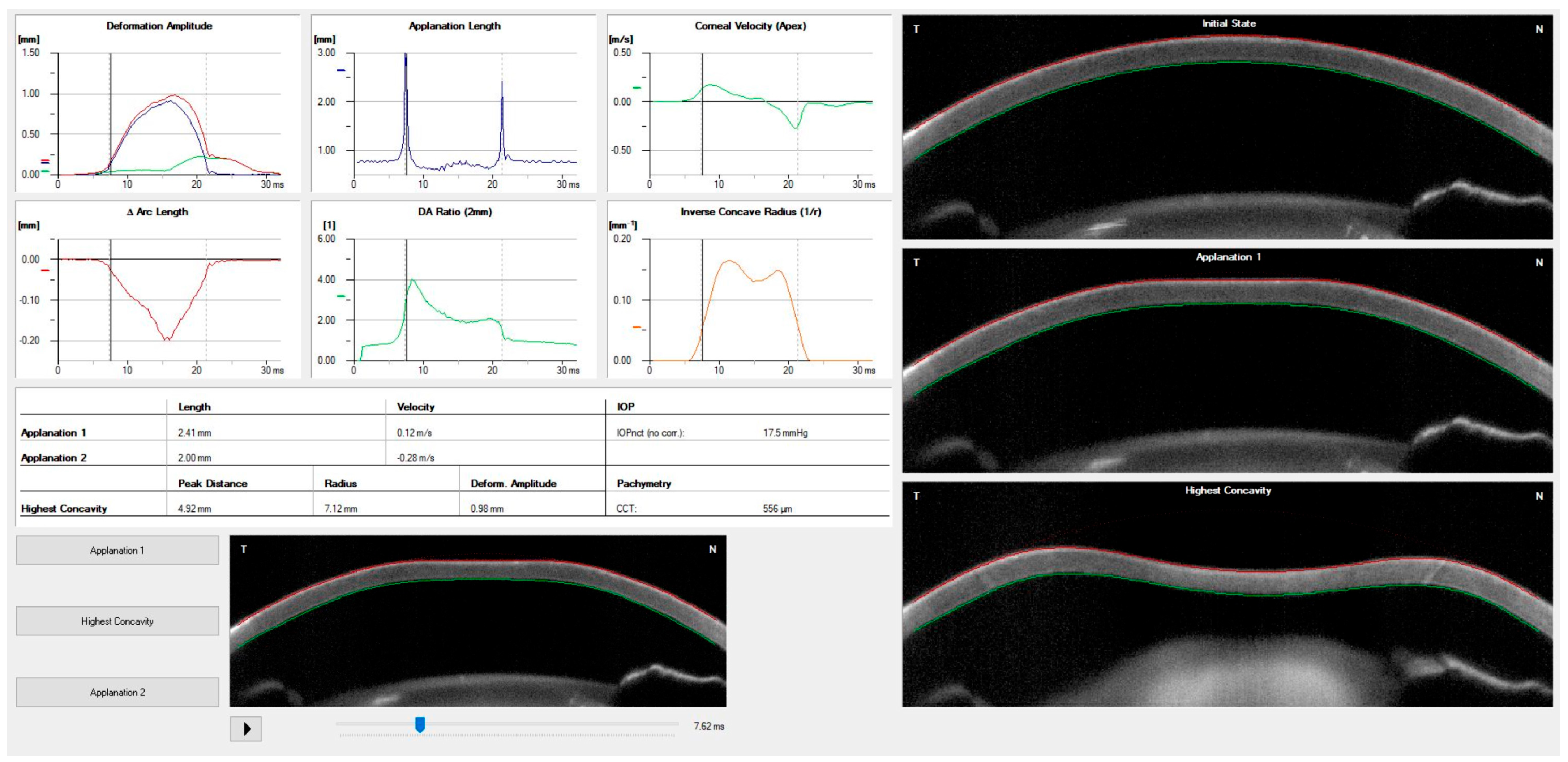 Vision 07 00036 g004 Vision 07 00036 g004