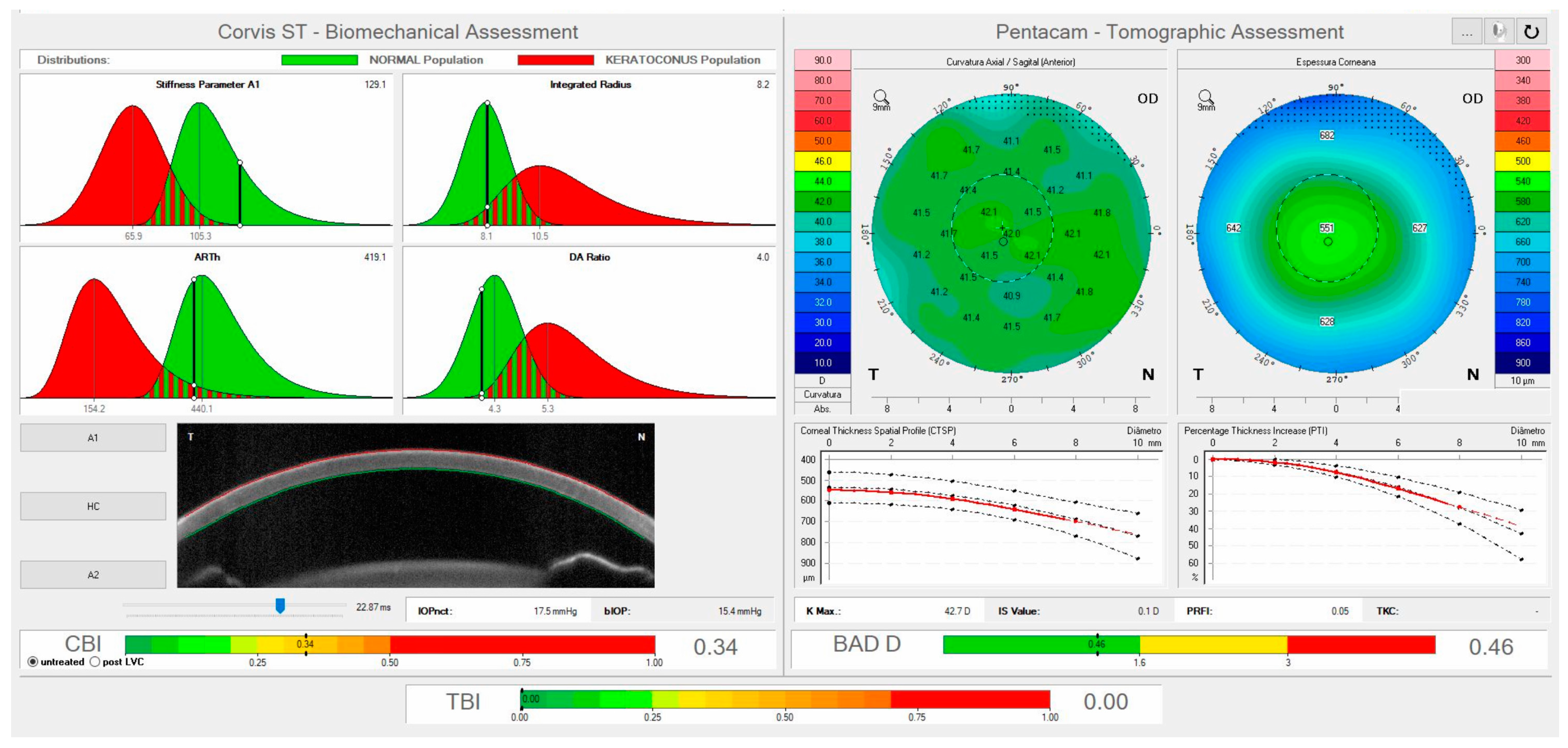 Vision 07 00036 g006 Vision 07 00036 g006