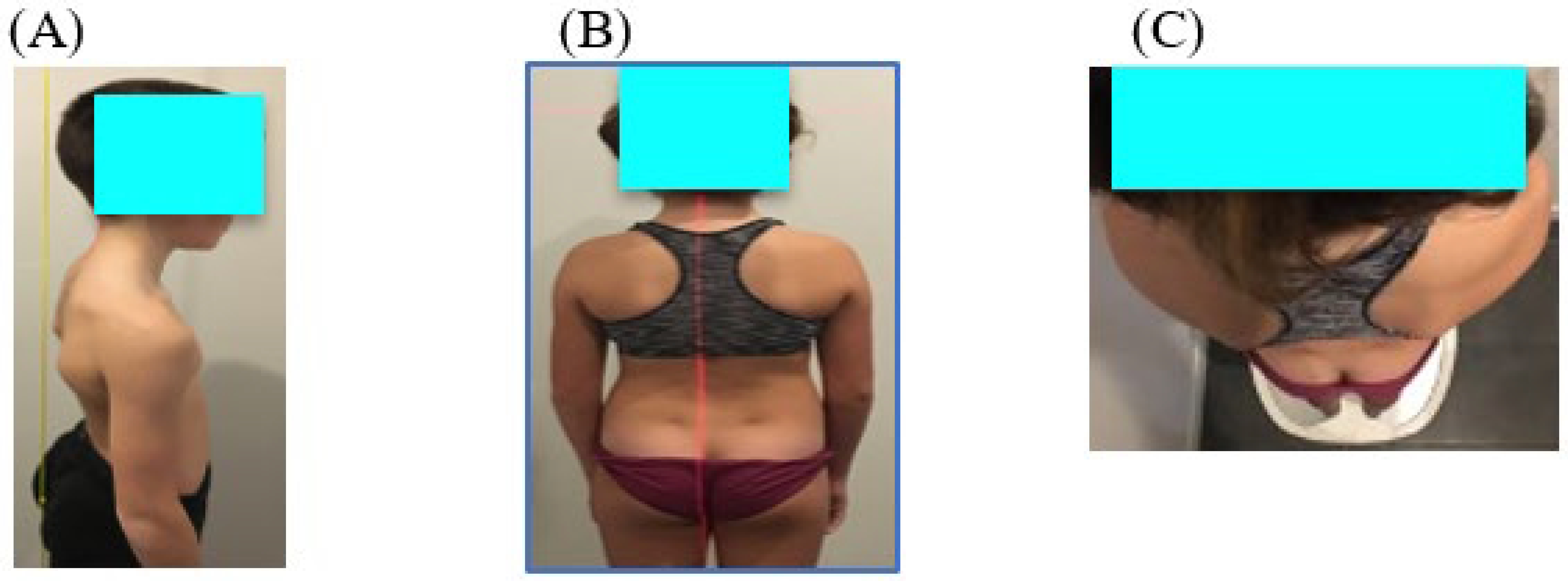 Vision 07 00037 g002