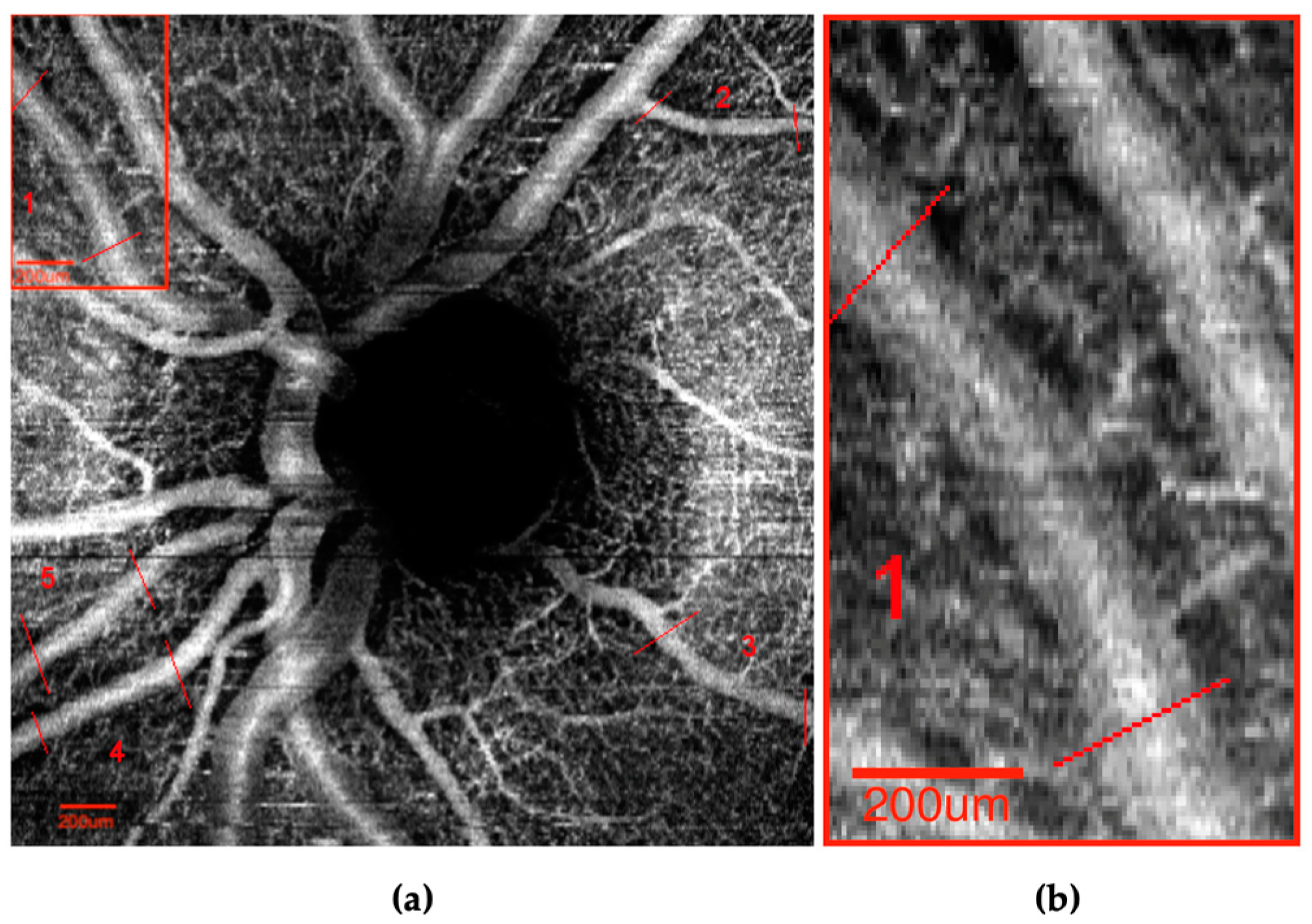 Vision 07 00048 g002 Vision 07 00048 g002