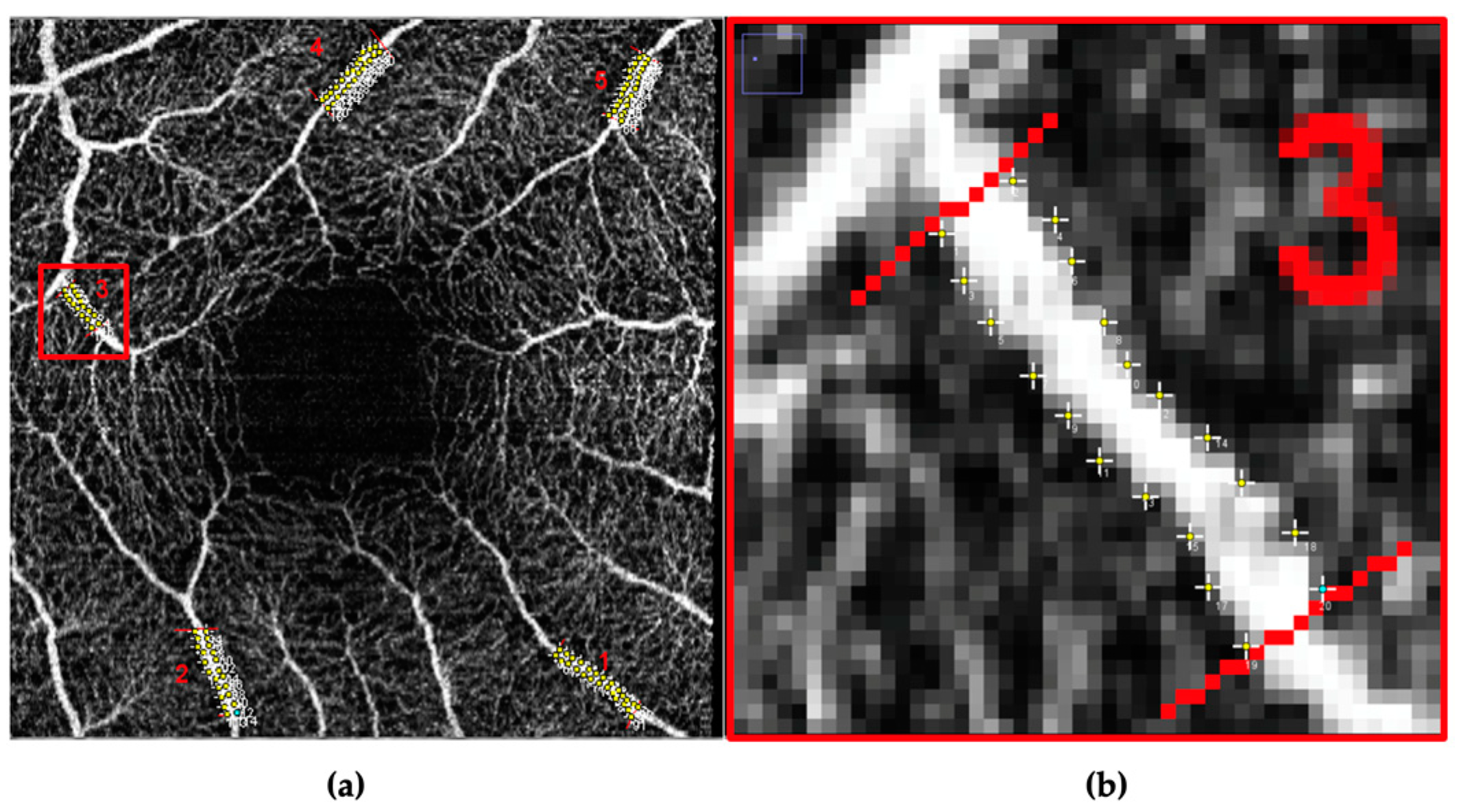 Vision 07 00048 g003 Vision 07 00048 g003