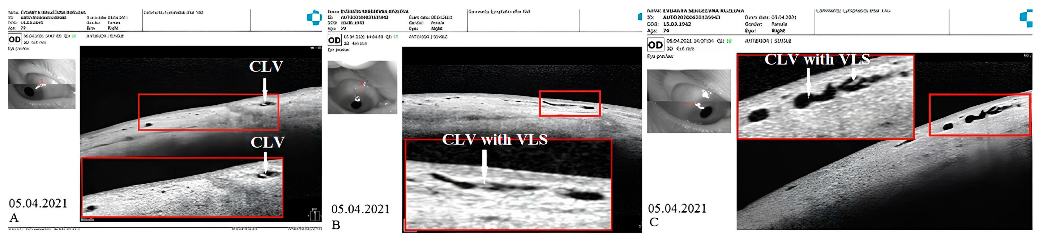 Vision 07 00059 g011