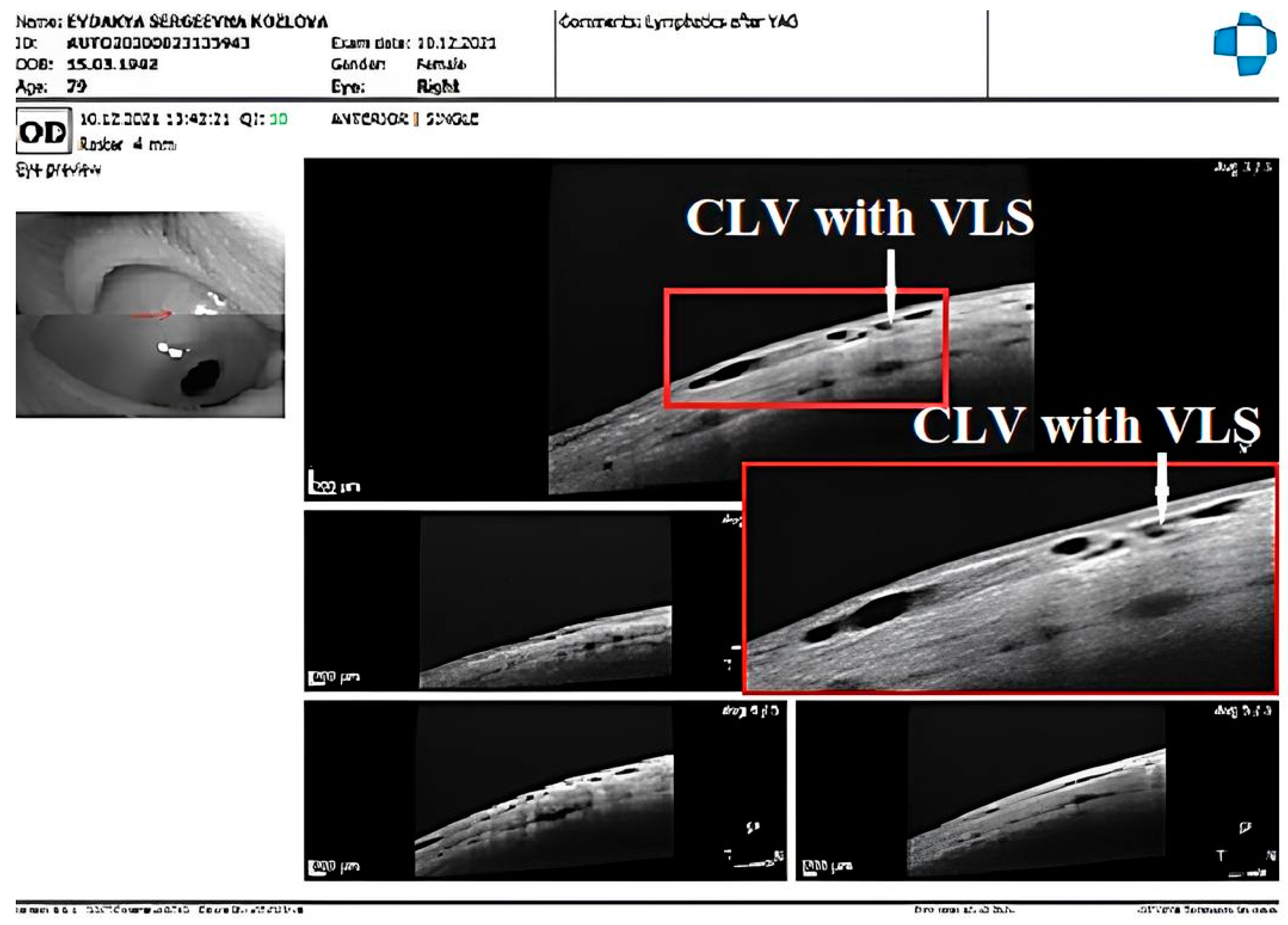 Vision 07 00059 g013