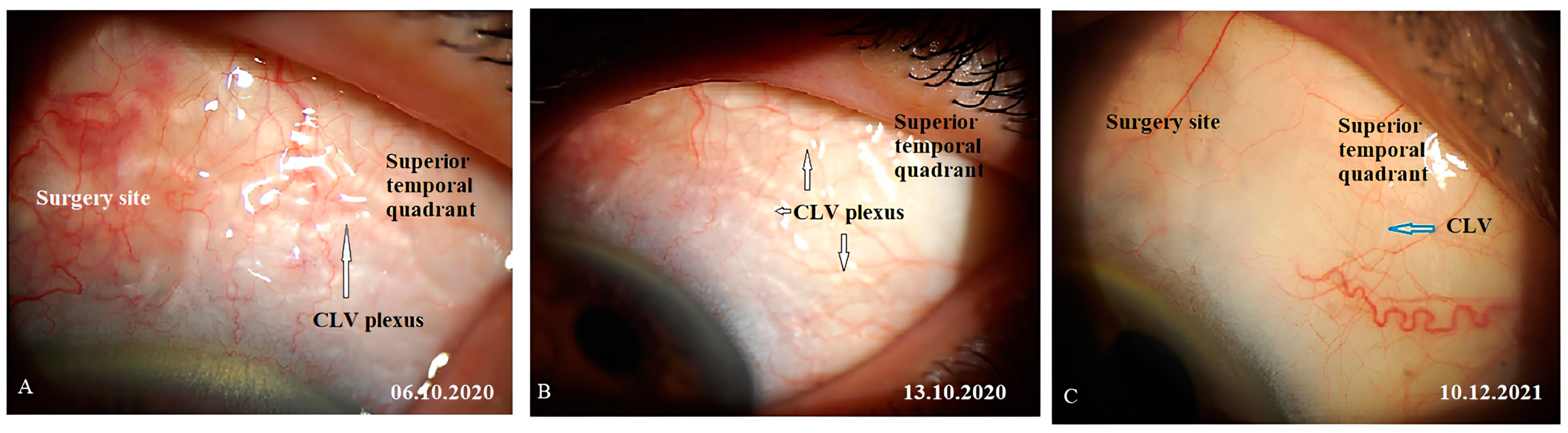 Vision 07 00059 g014