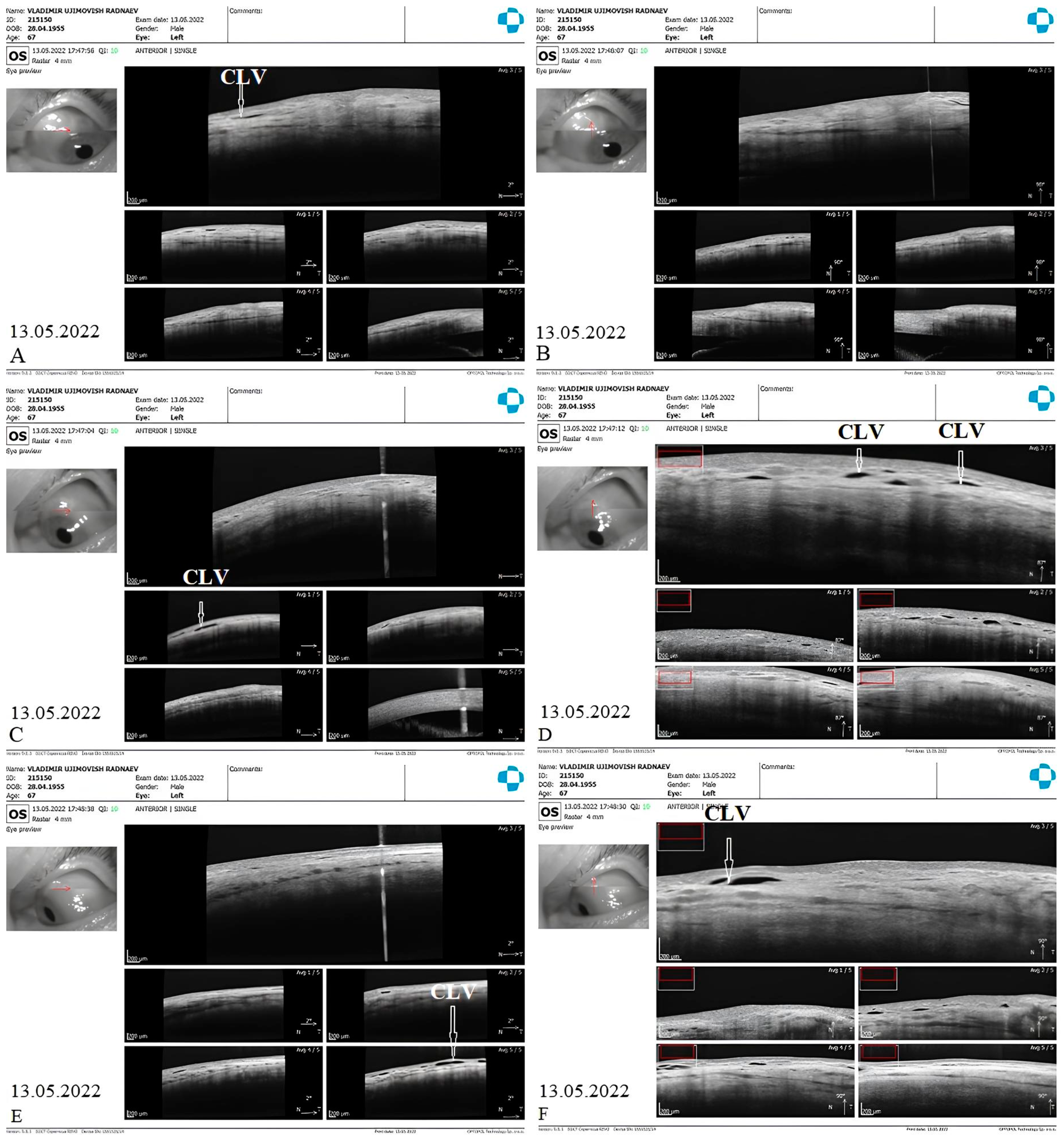Vision 07 00059 g017