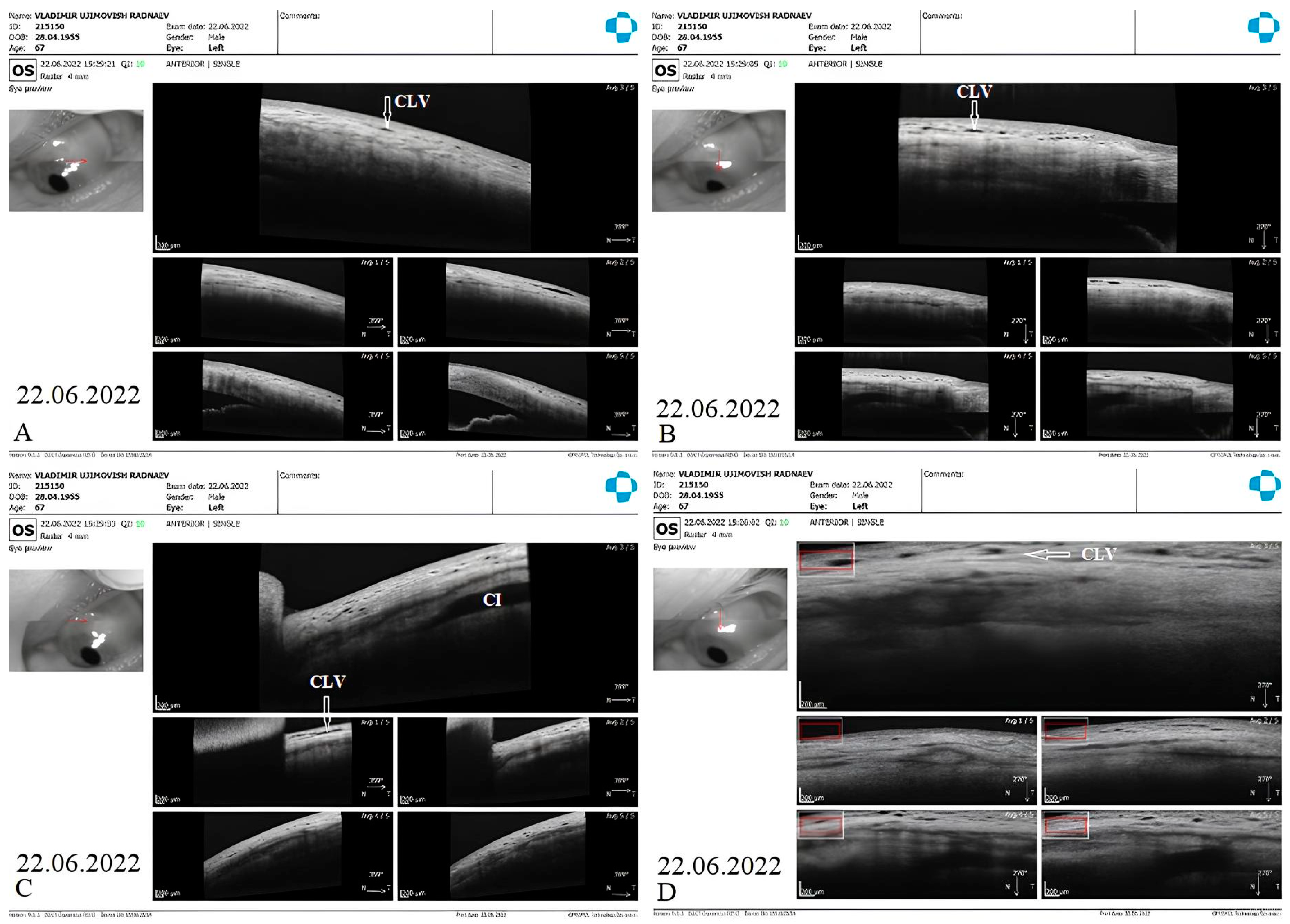 Vision 07 00059 g019