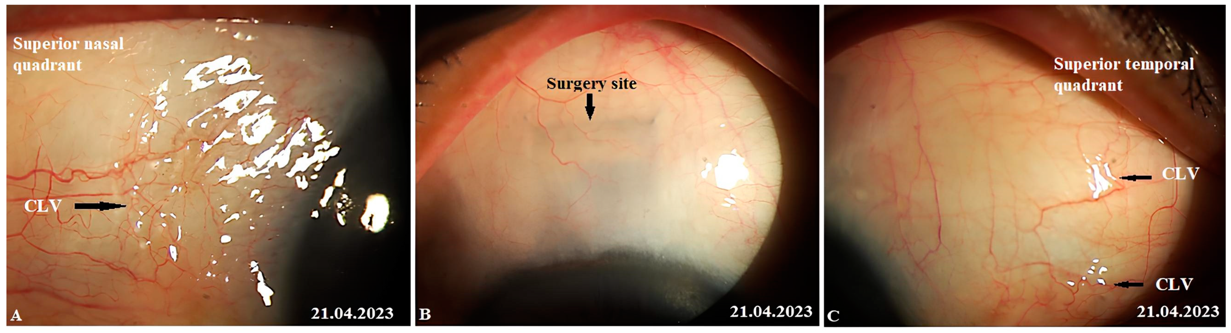 Vision 07 00059 g020