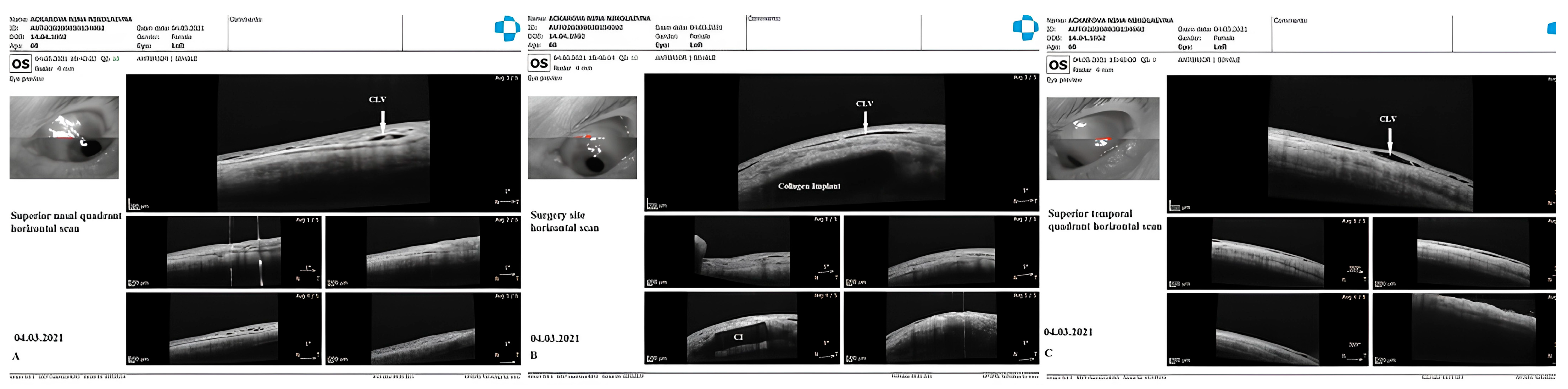 Vision 07 00059 g022