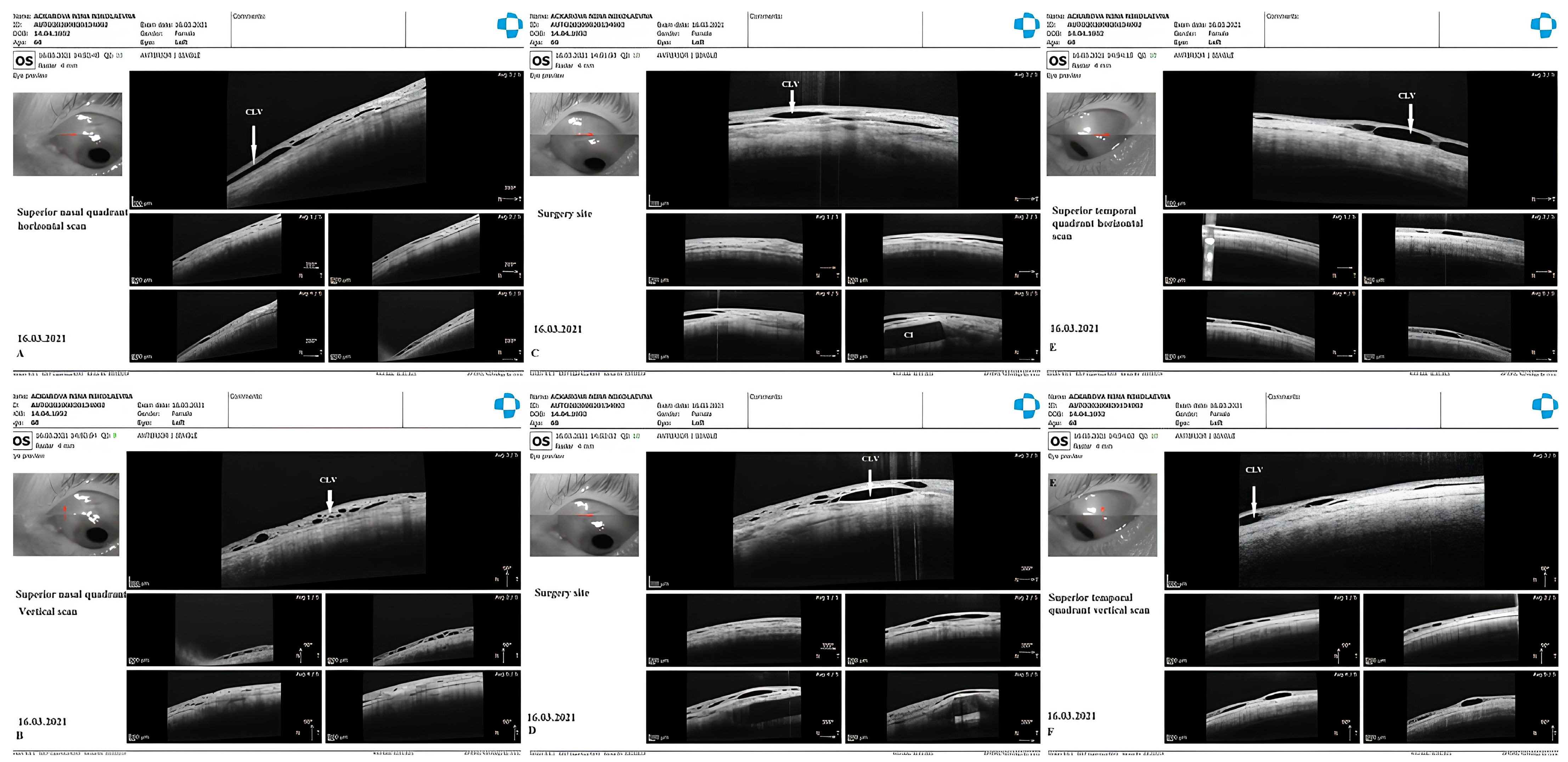 Vision 07 00059 g023
