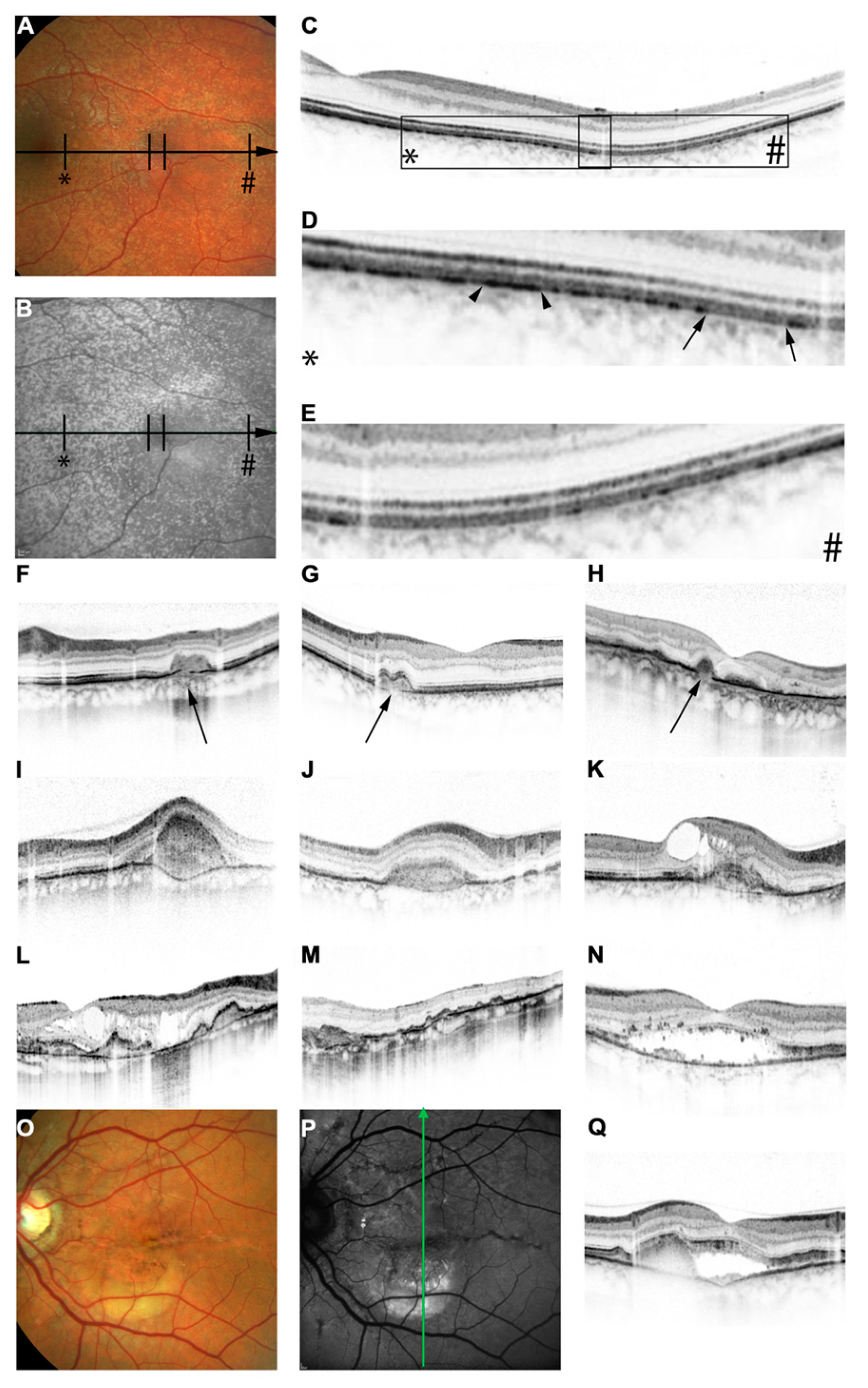 Vision 08 00010 g003 Vision 08 00010 g003