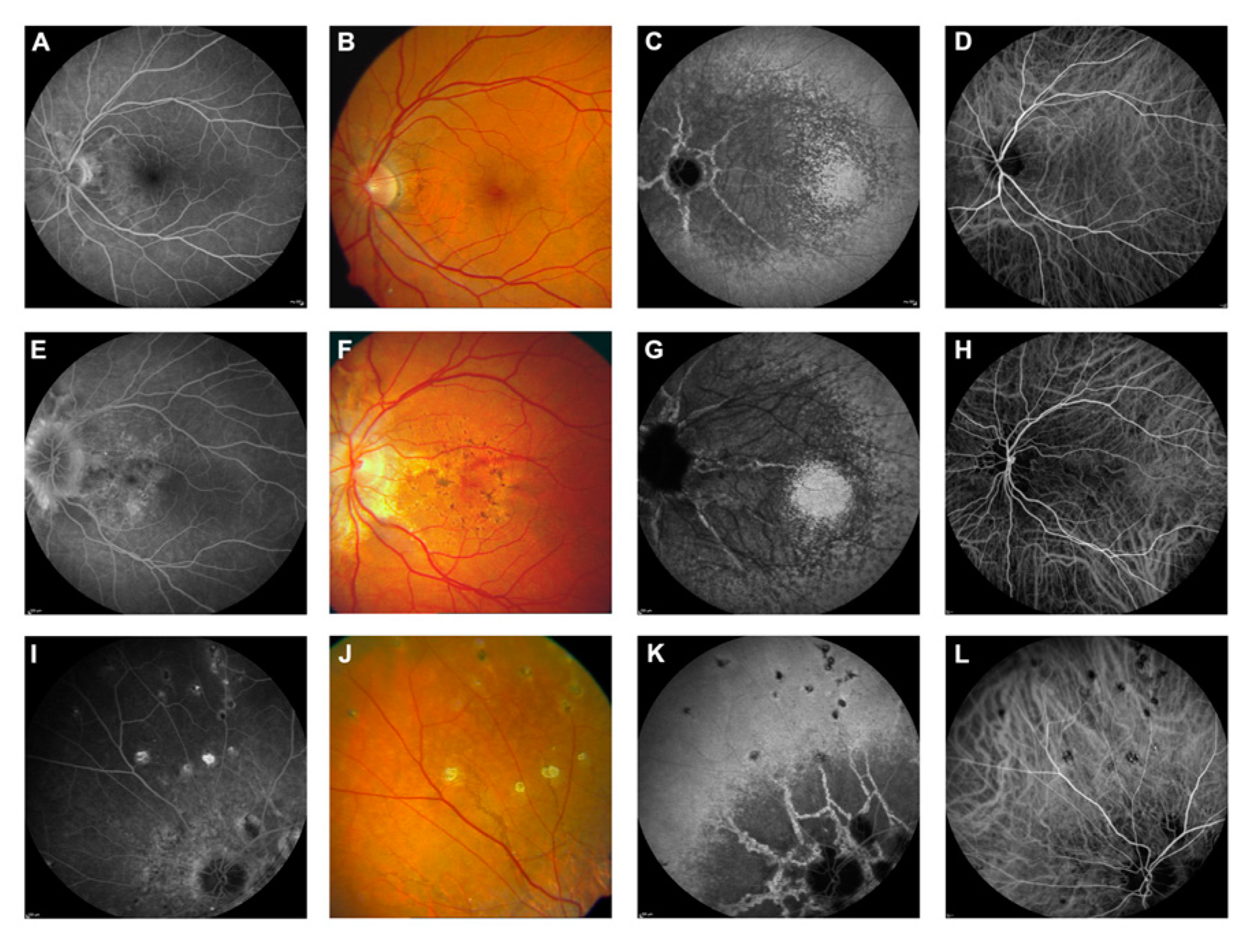 Vision 08 00010 g006 Vision 08 00010 g006