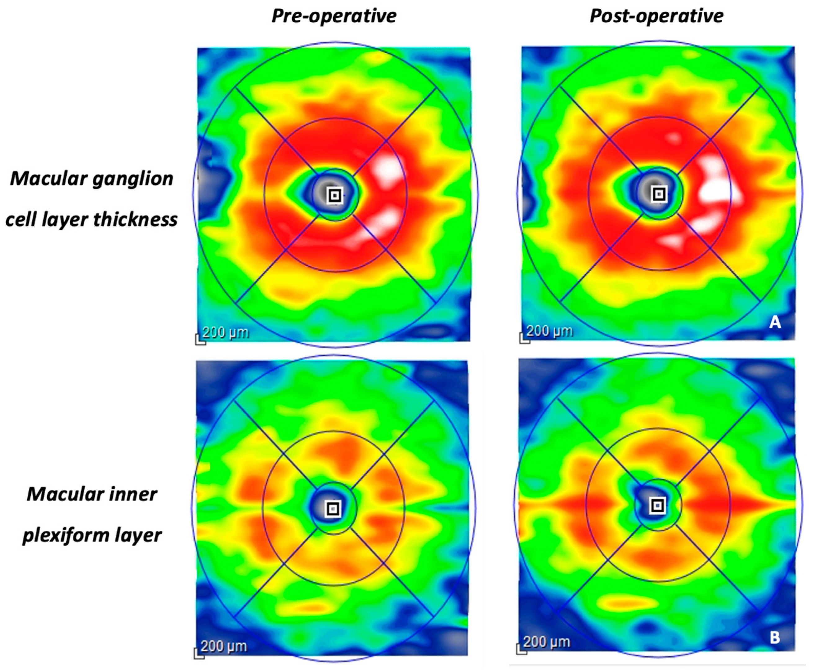 Vision 08 00021 g002