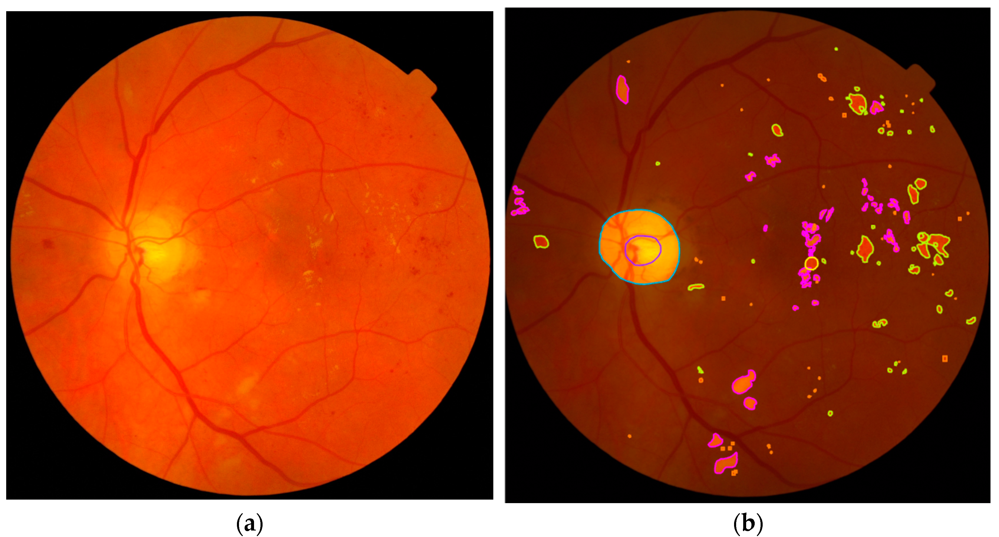 Vision 08 00048 g001a
