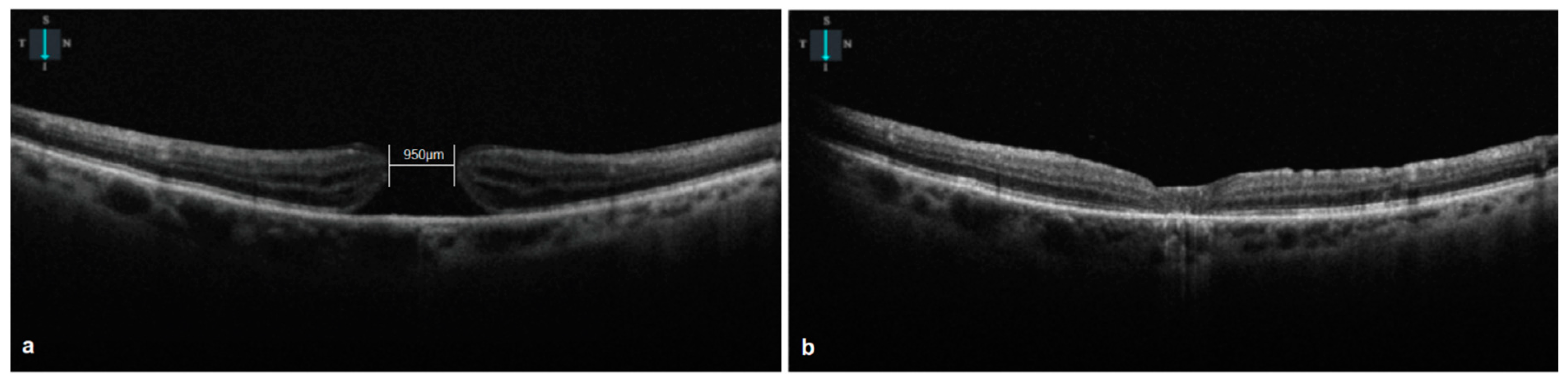 Vision 08 00063 g001