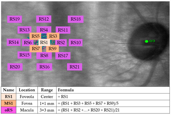 Characterizing the Preferred Retinal Locus and Fixation Stability in ...