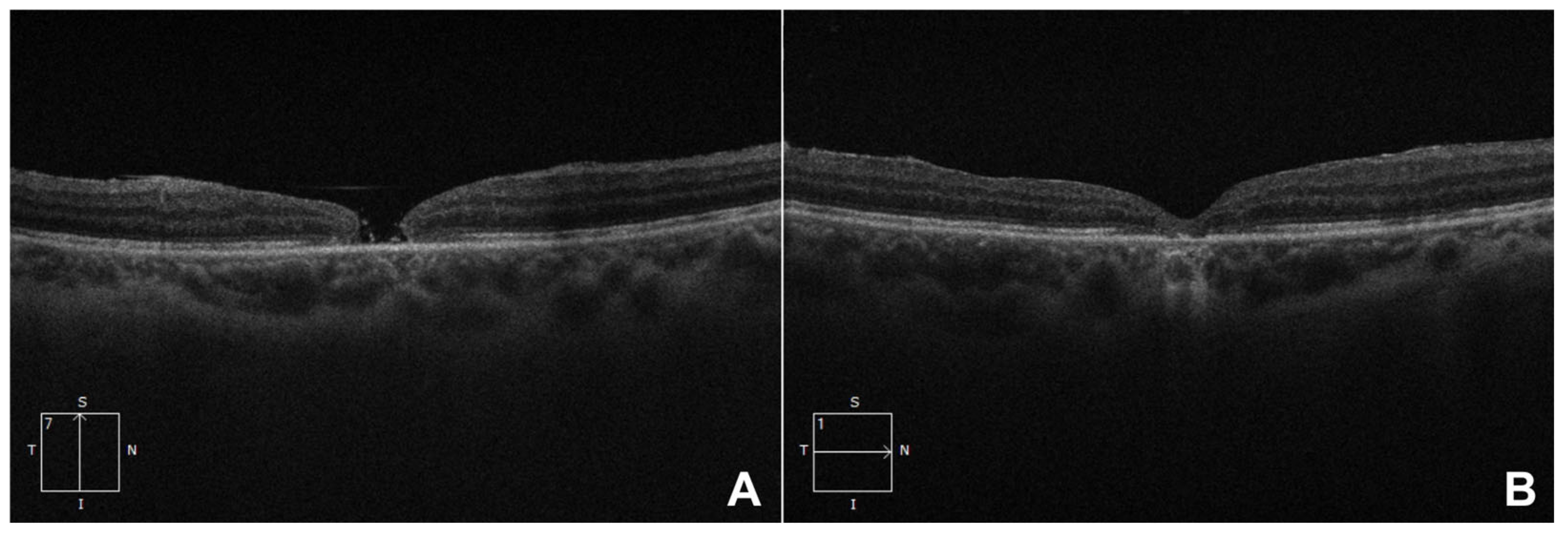 Vision 09 00045 g001