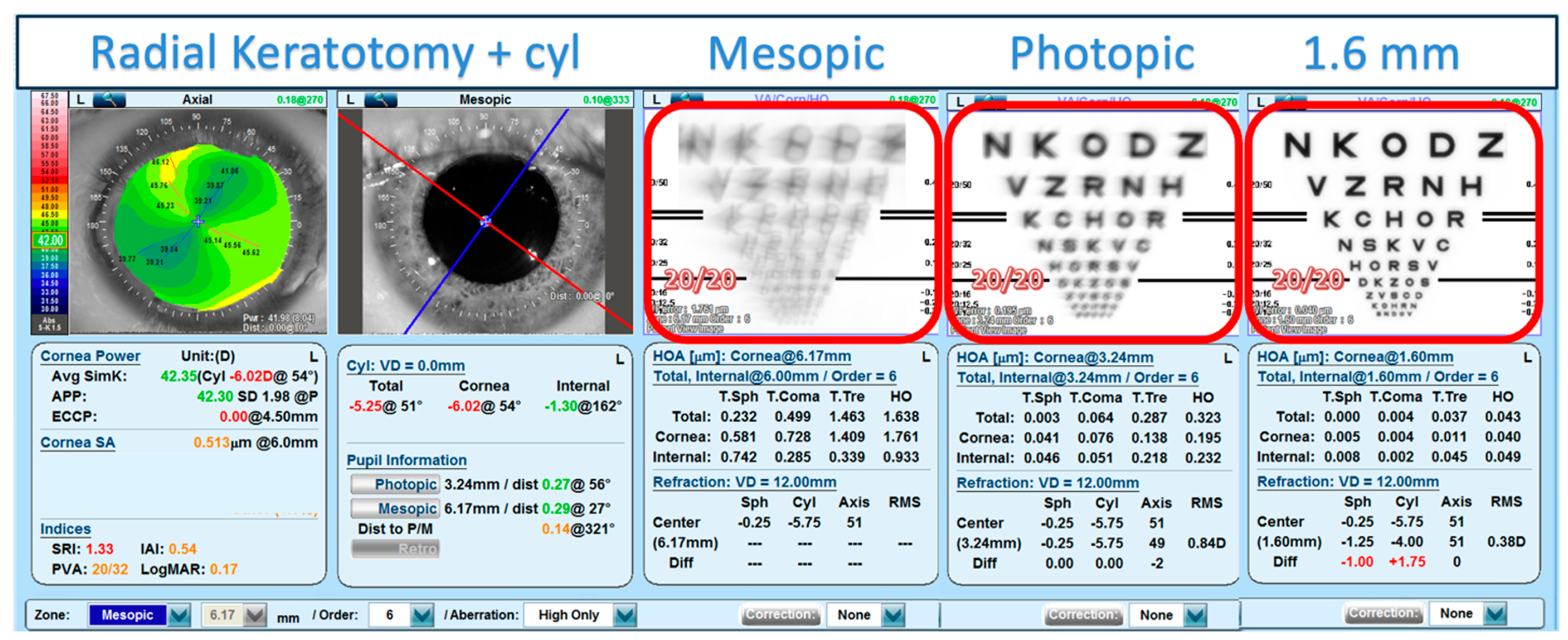 Eye Involvement in Wilson's Disease: A Review of the Literature