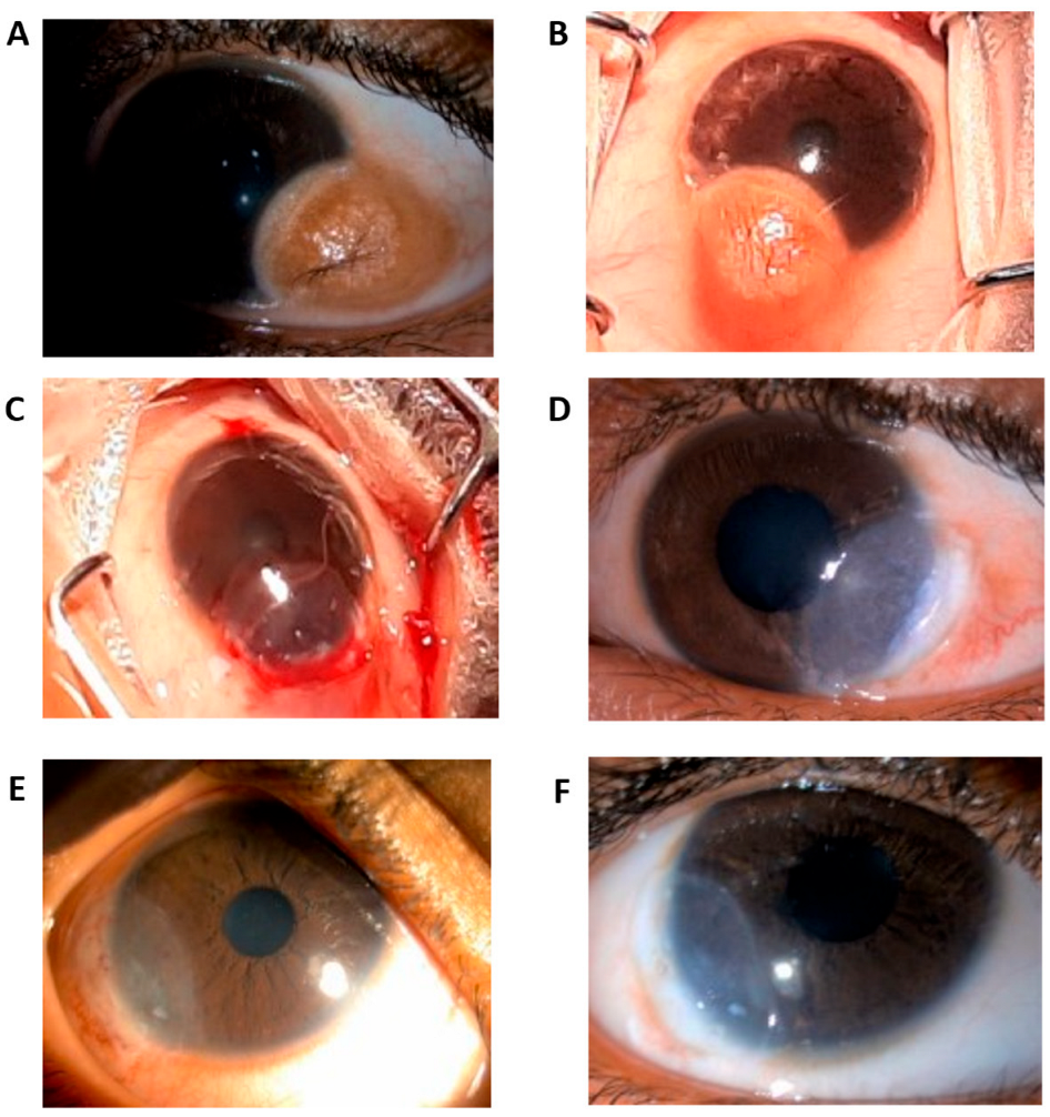 Vision 09 00056 g001