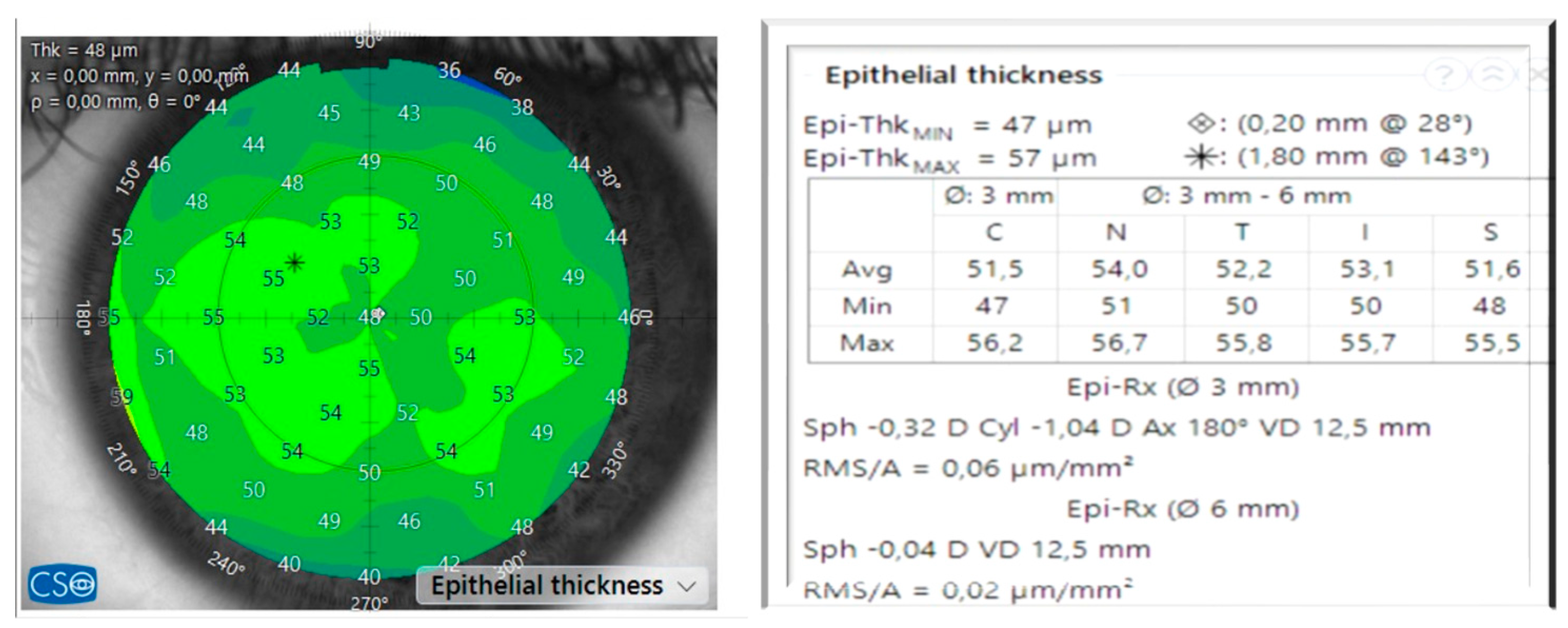 Vision 09 00057 g004